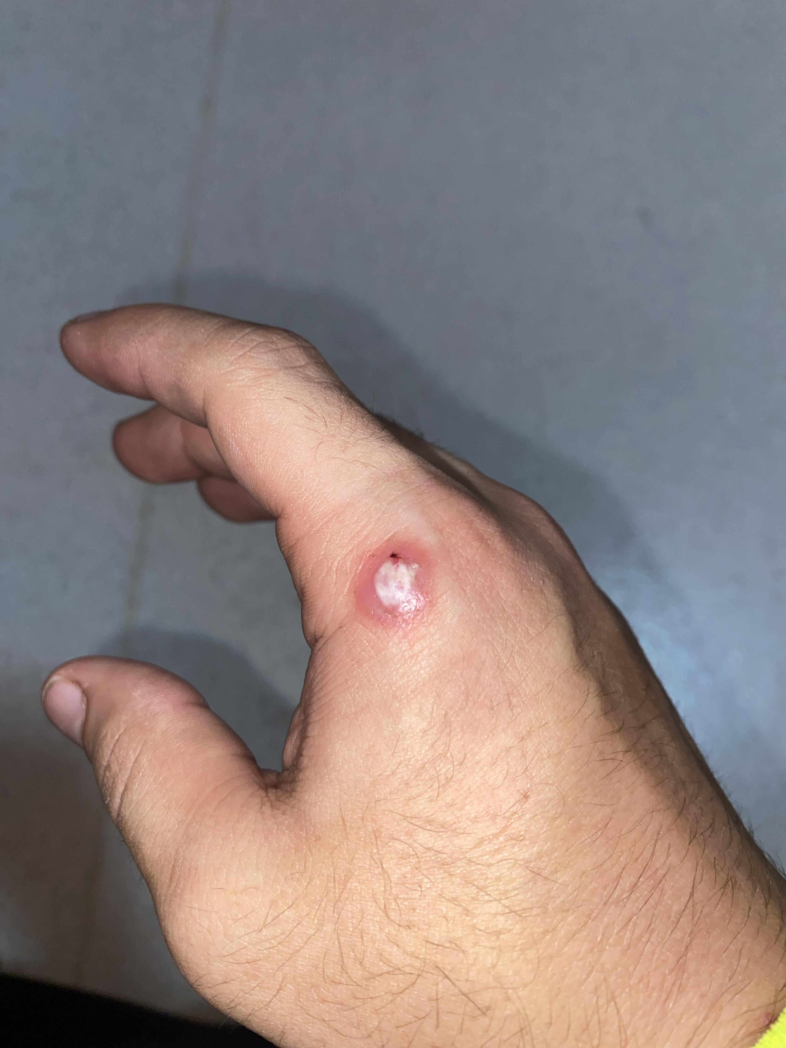 Took the white stuff off now it looks like this do I just take all that