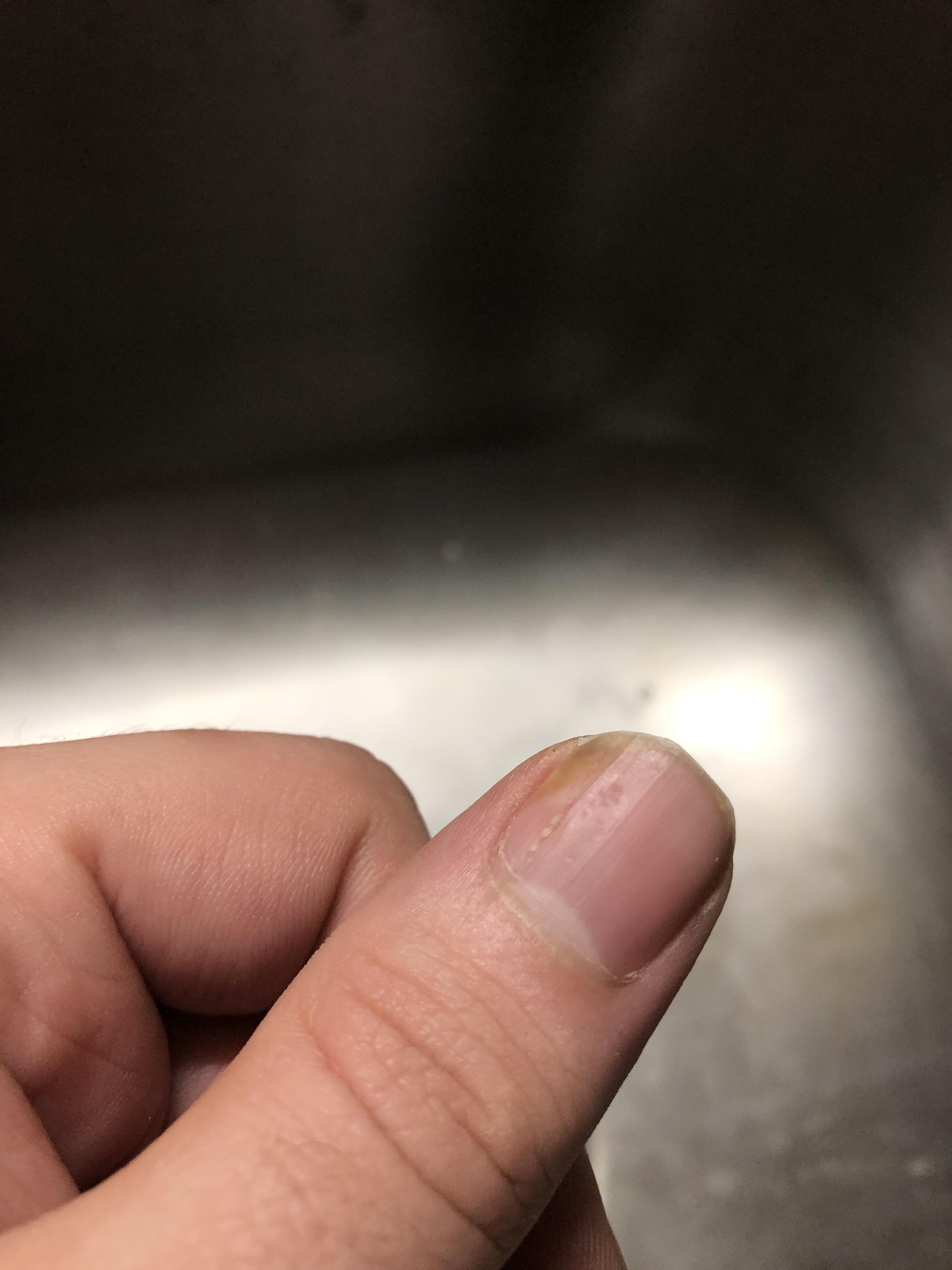 New to this sub. Just wondering if you guys have this issue with your