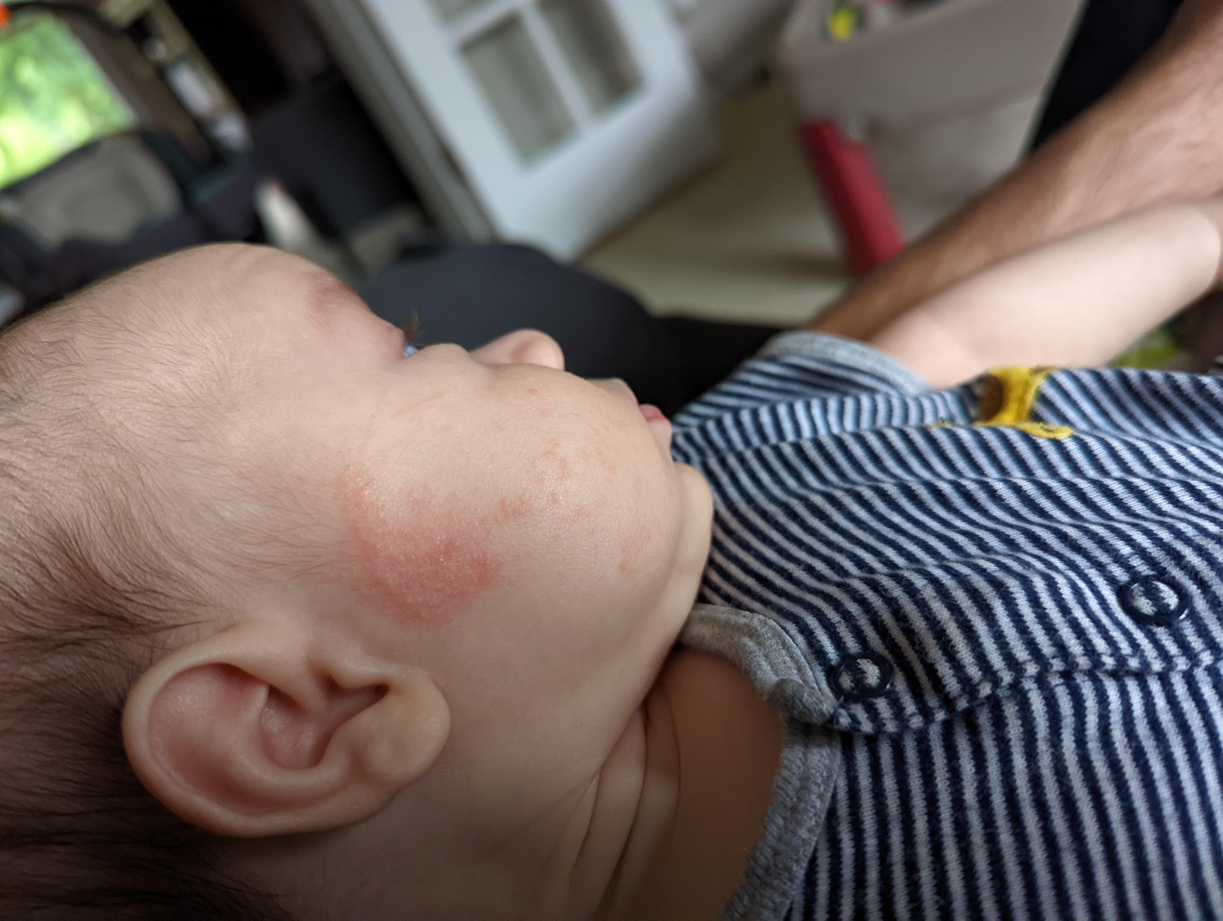 does anyone have an idea of what's going on with my baby face here? r