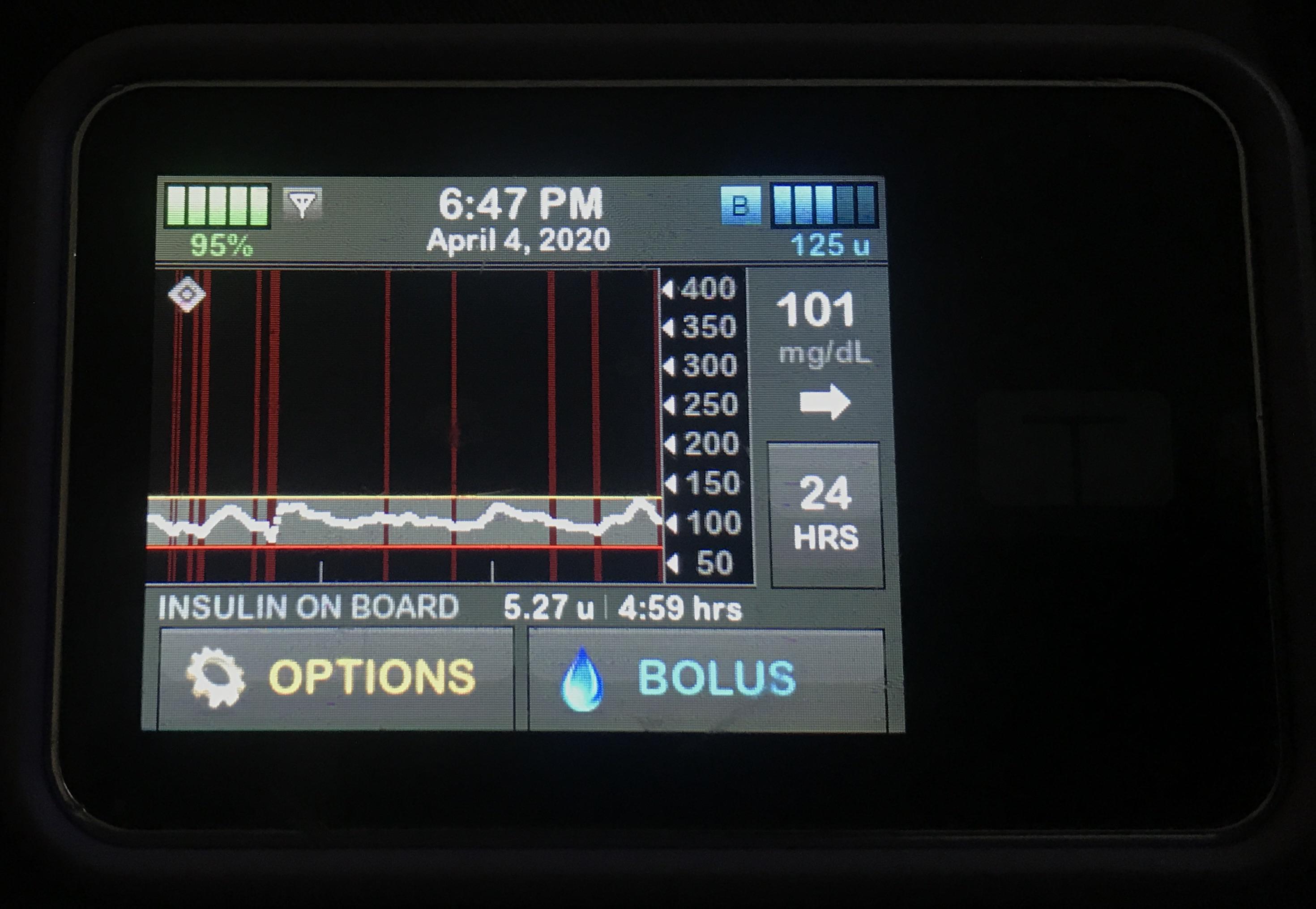 Tandem TSlim X2 plus G6 — just another day in the future of