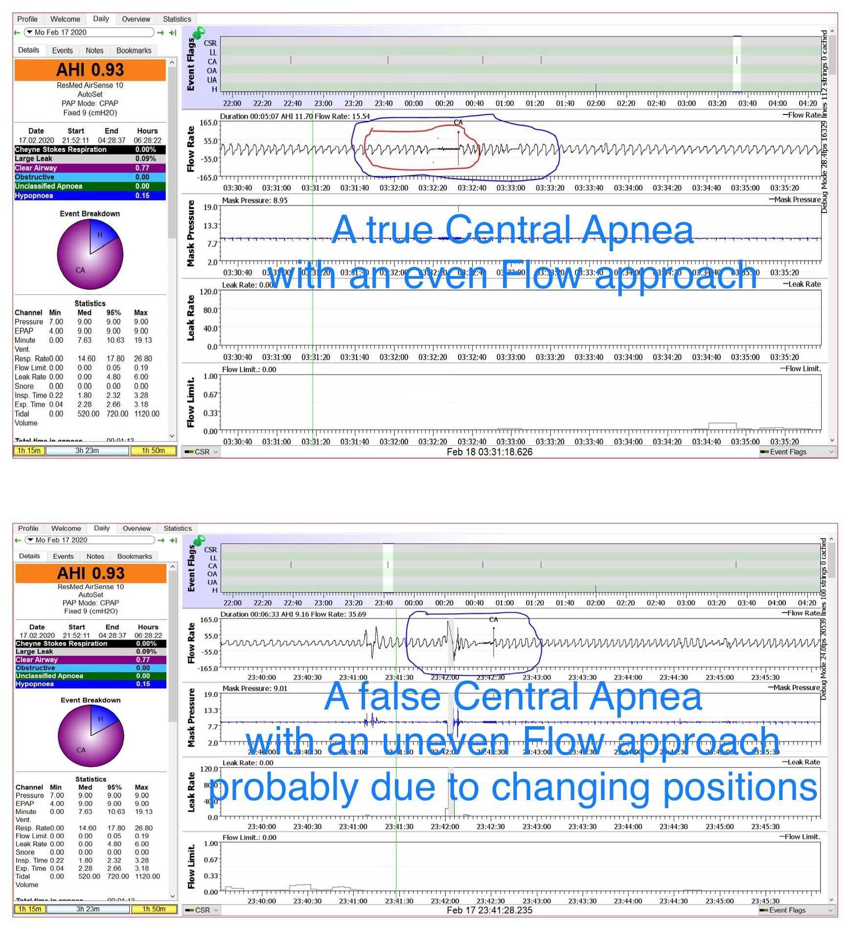 When you look at your data in Oscar this is how to tell the difference between a true and a