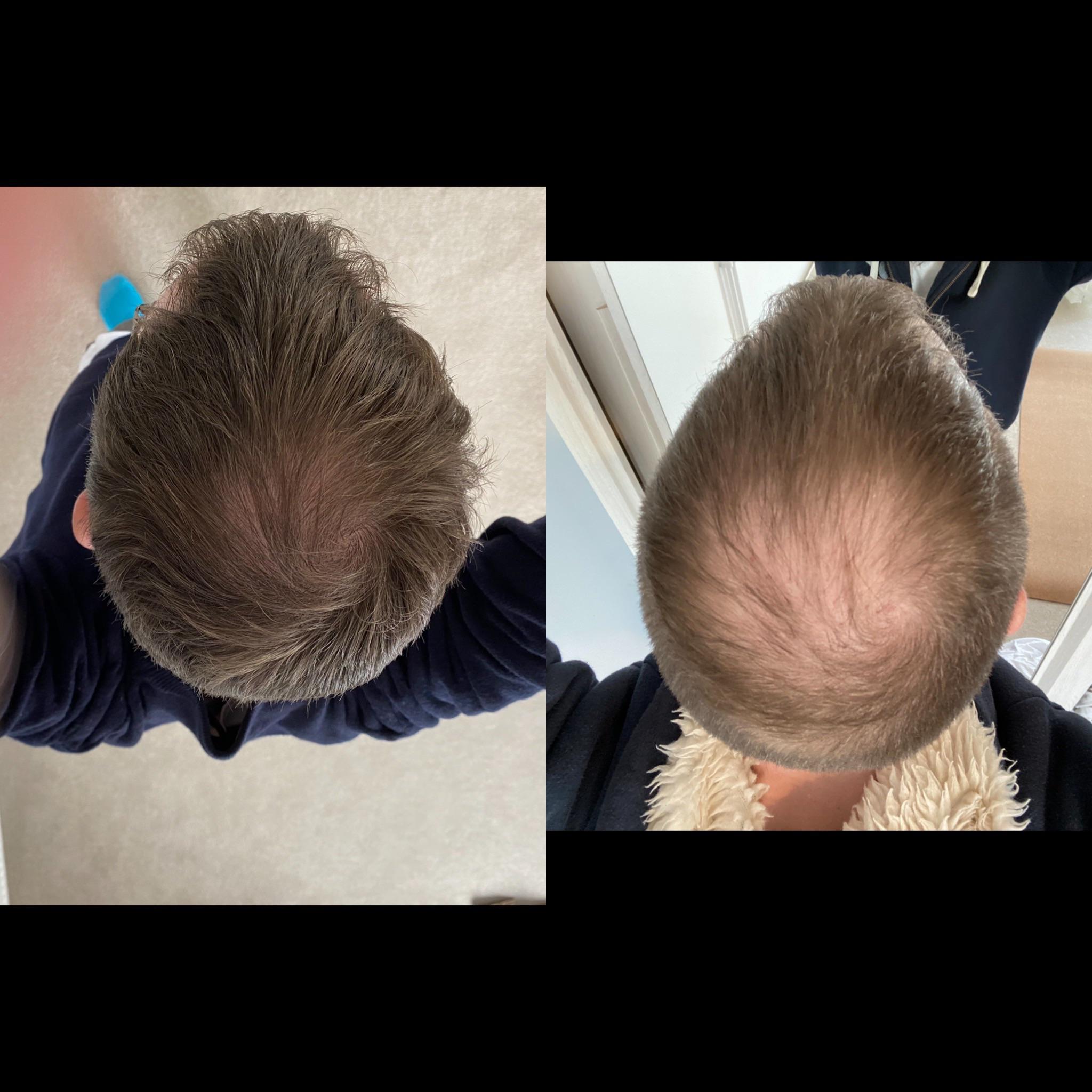 20 best u/xgeuario images on Pholder Superstonk, Amcstock and Green