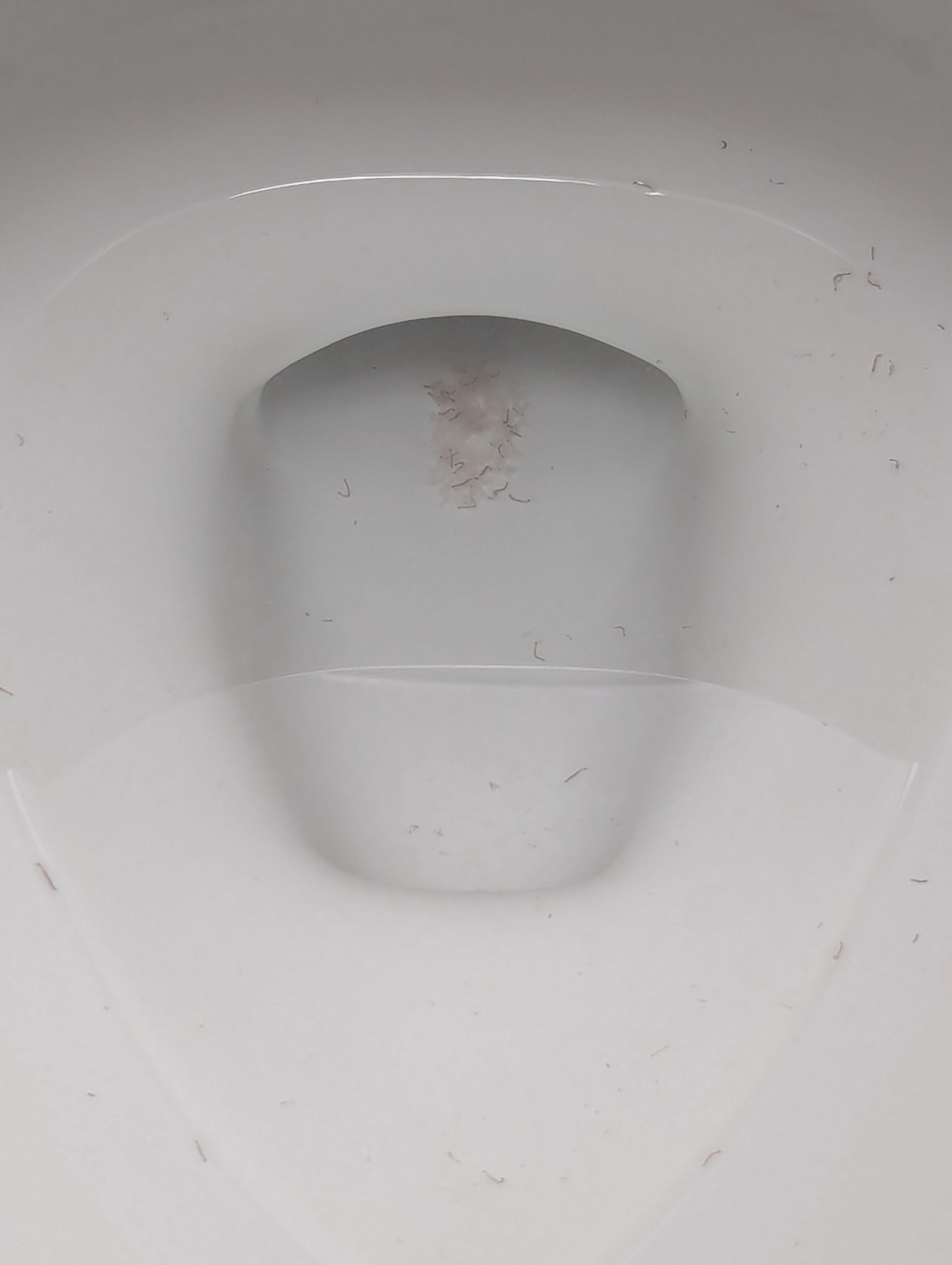 What are these things growing in my toilet and what to do? r/askaplumber