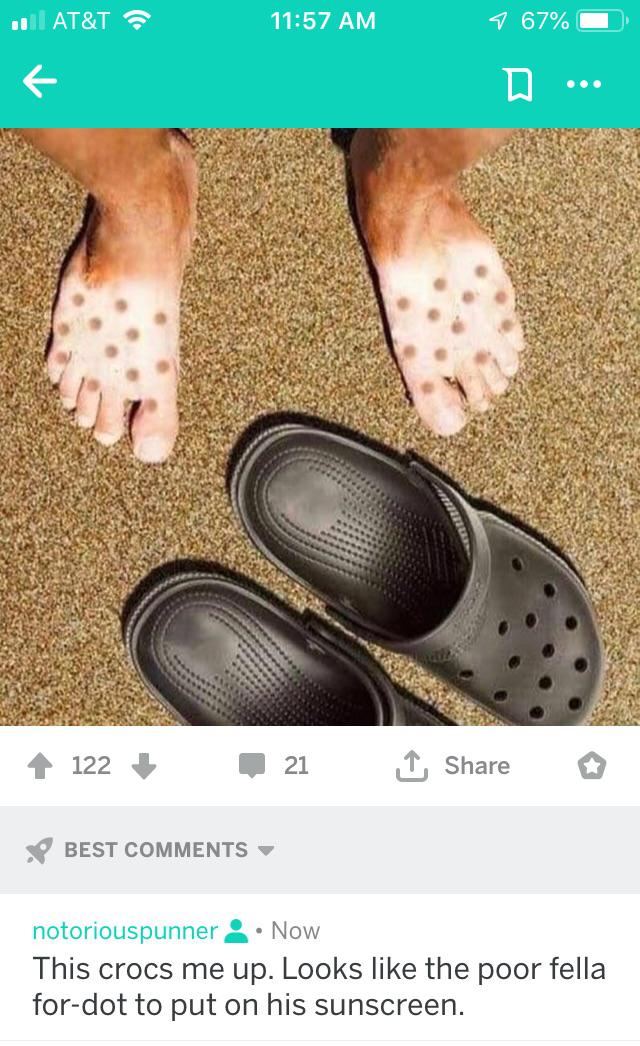His feet look toe up. r/puns