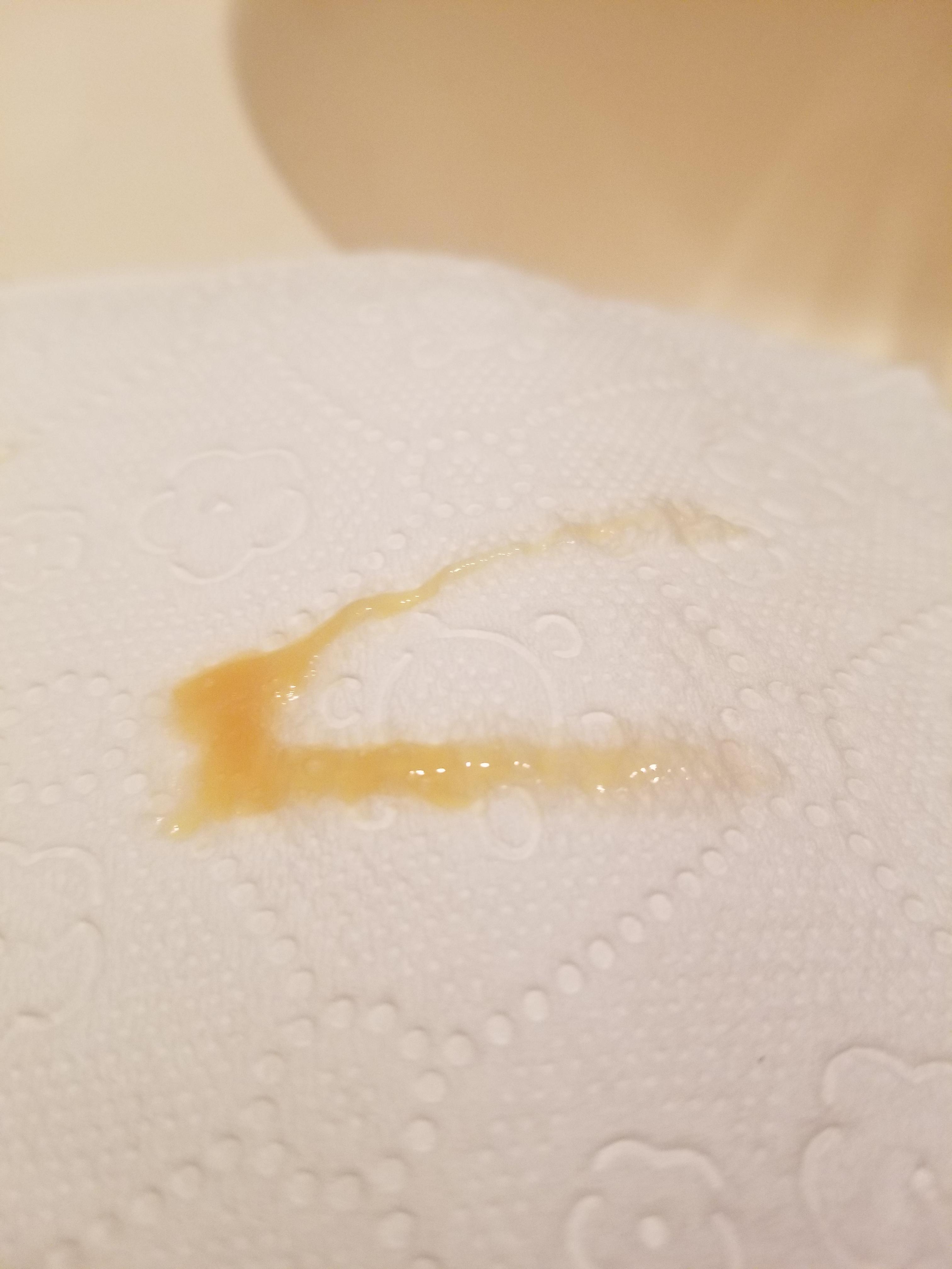 Orange snot should I see someone medicaladvice