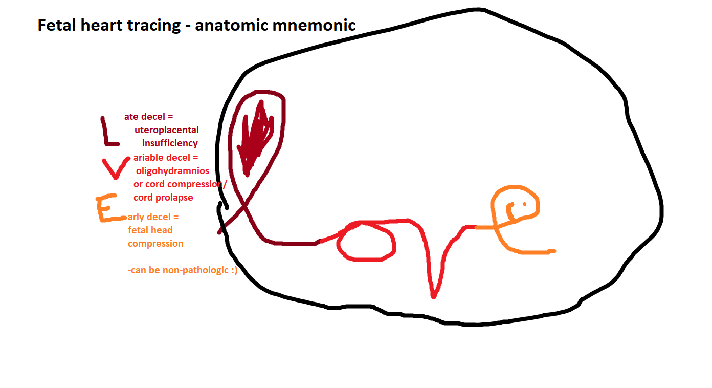 anatomic mnemonic for fetal heart tracings r/Step2