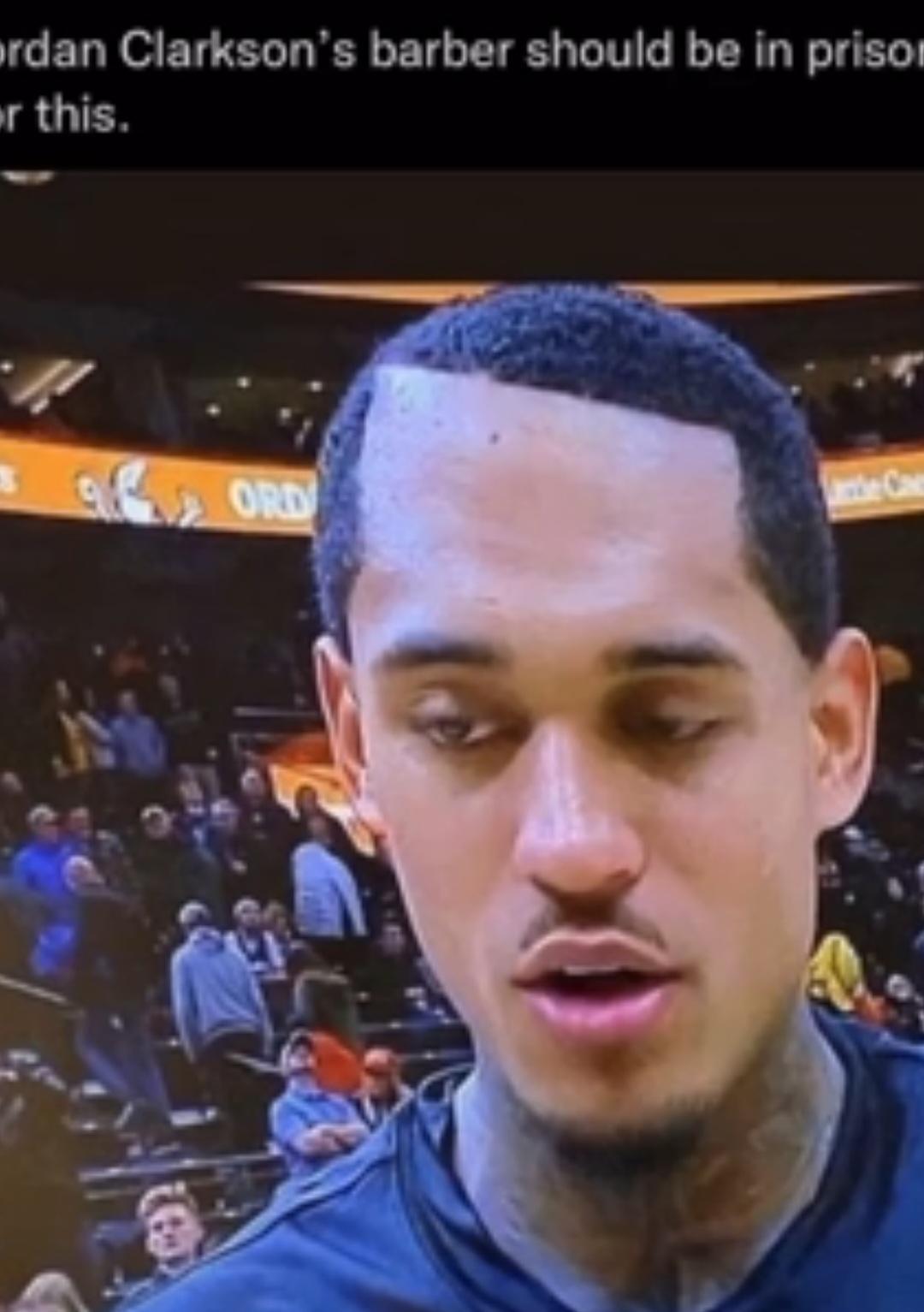 Goofy ahh hairline r/GoofyAhh