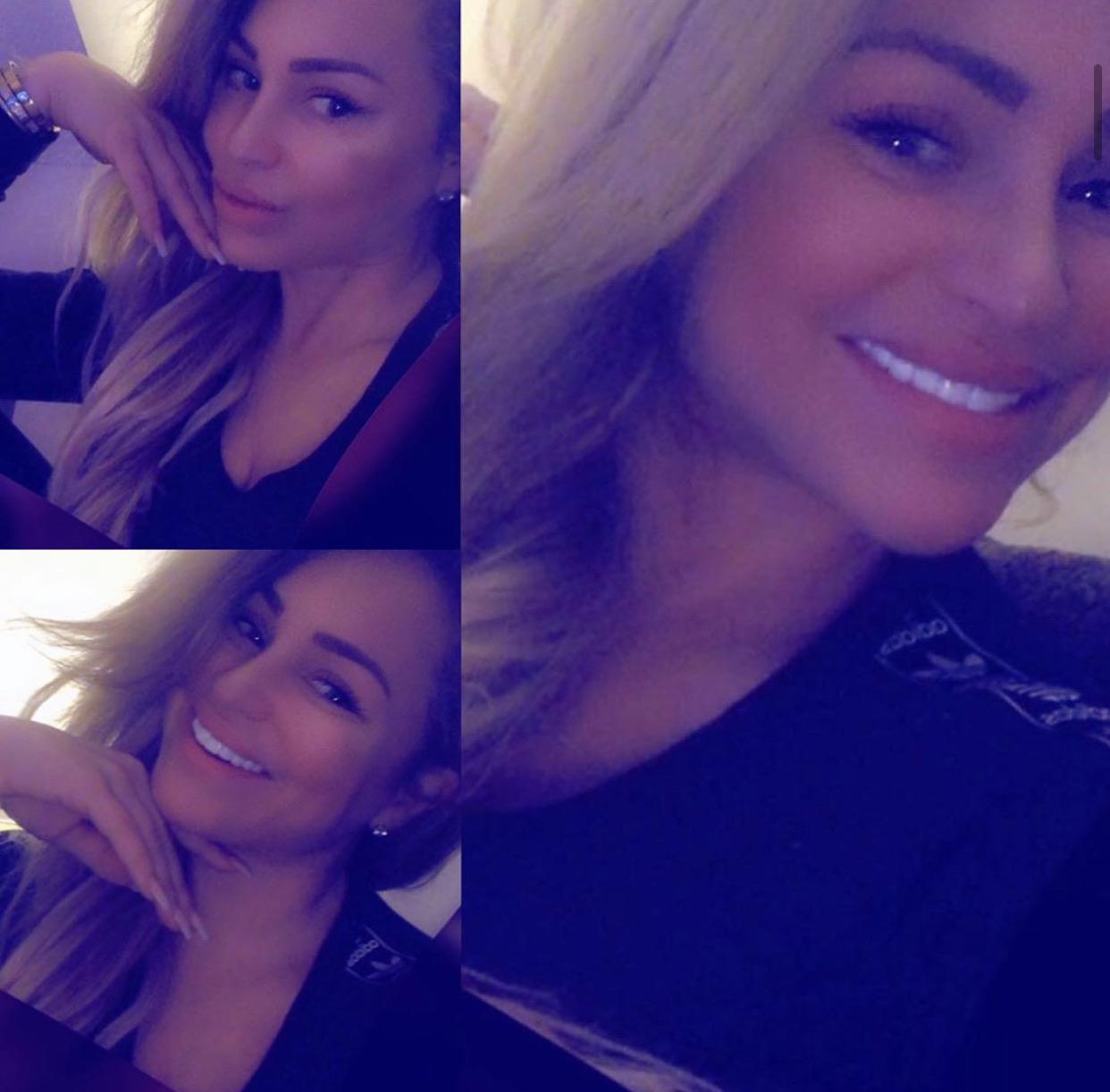 Introducing...Darcey’s new chiclets straight outta Turkey r/90DayFiance