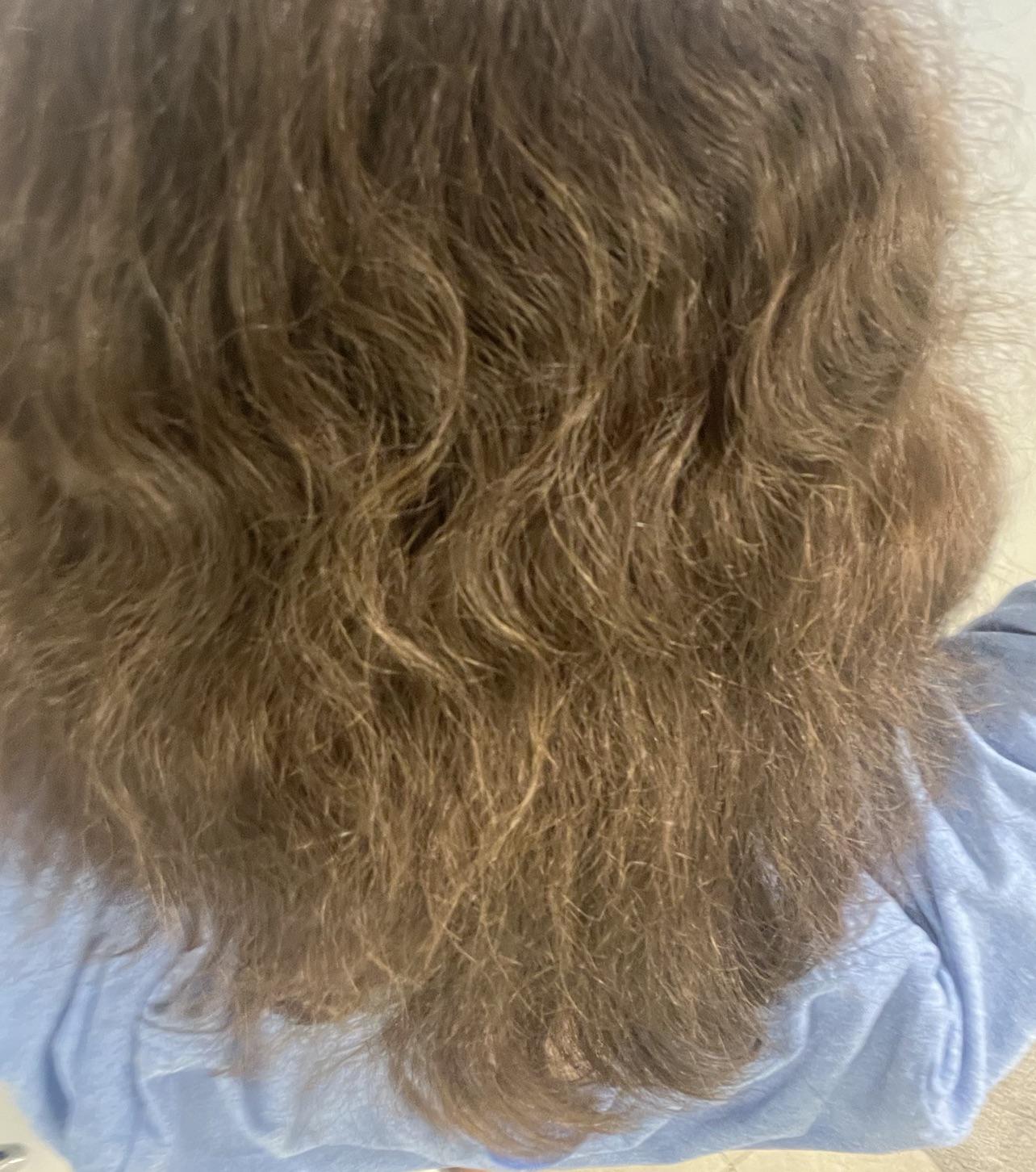 HELP my hair is VERY dry and fine r/Haircare