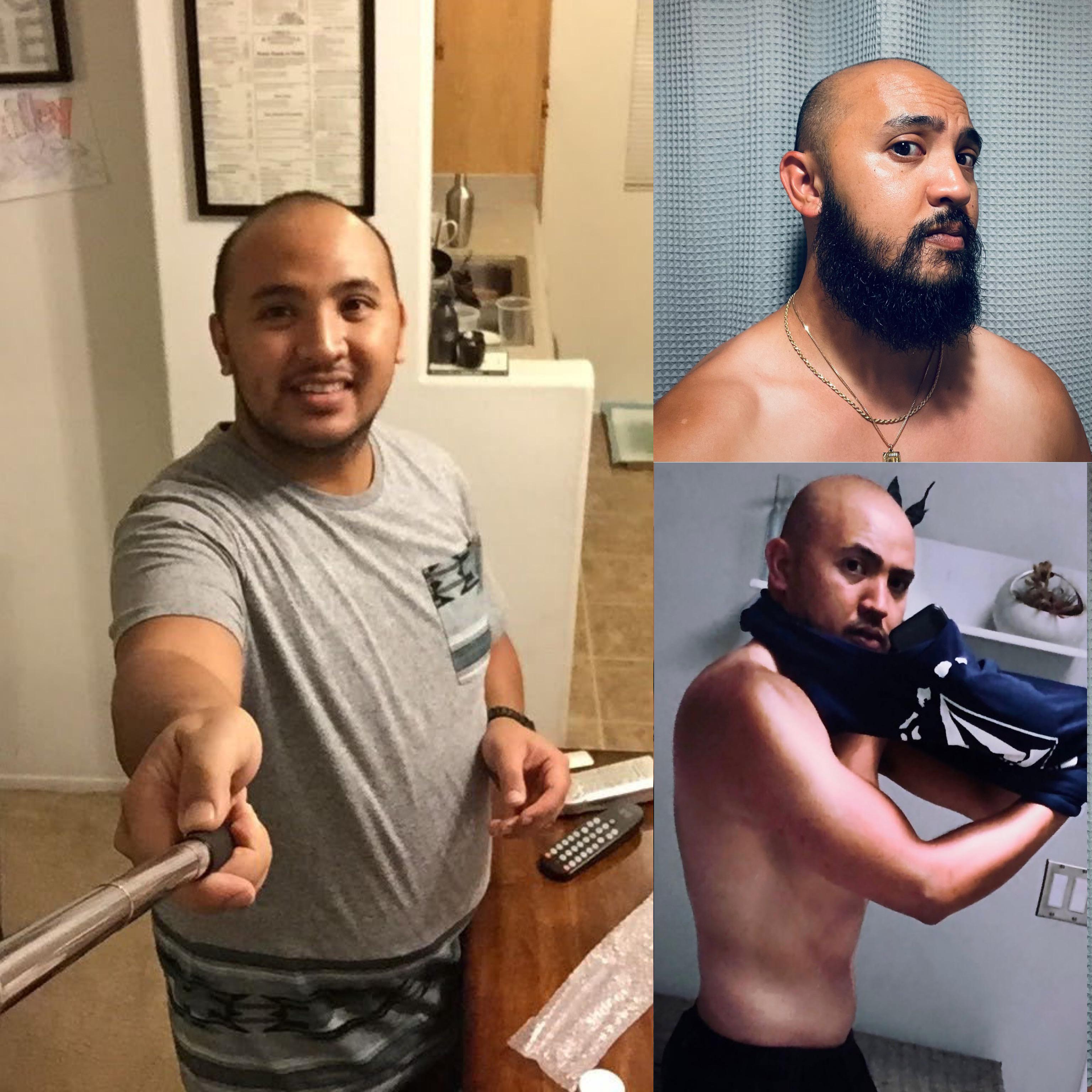Reddit told me to lose weight/gym, shave your head, grow a beard. r