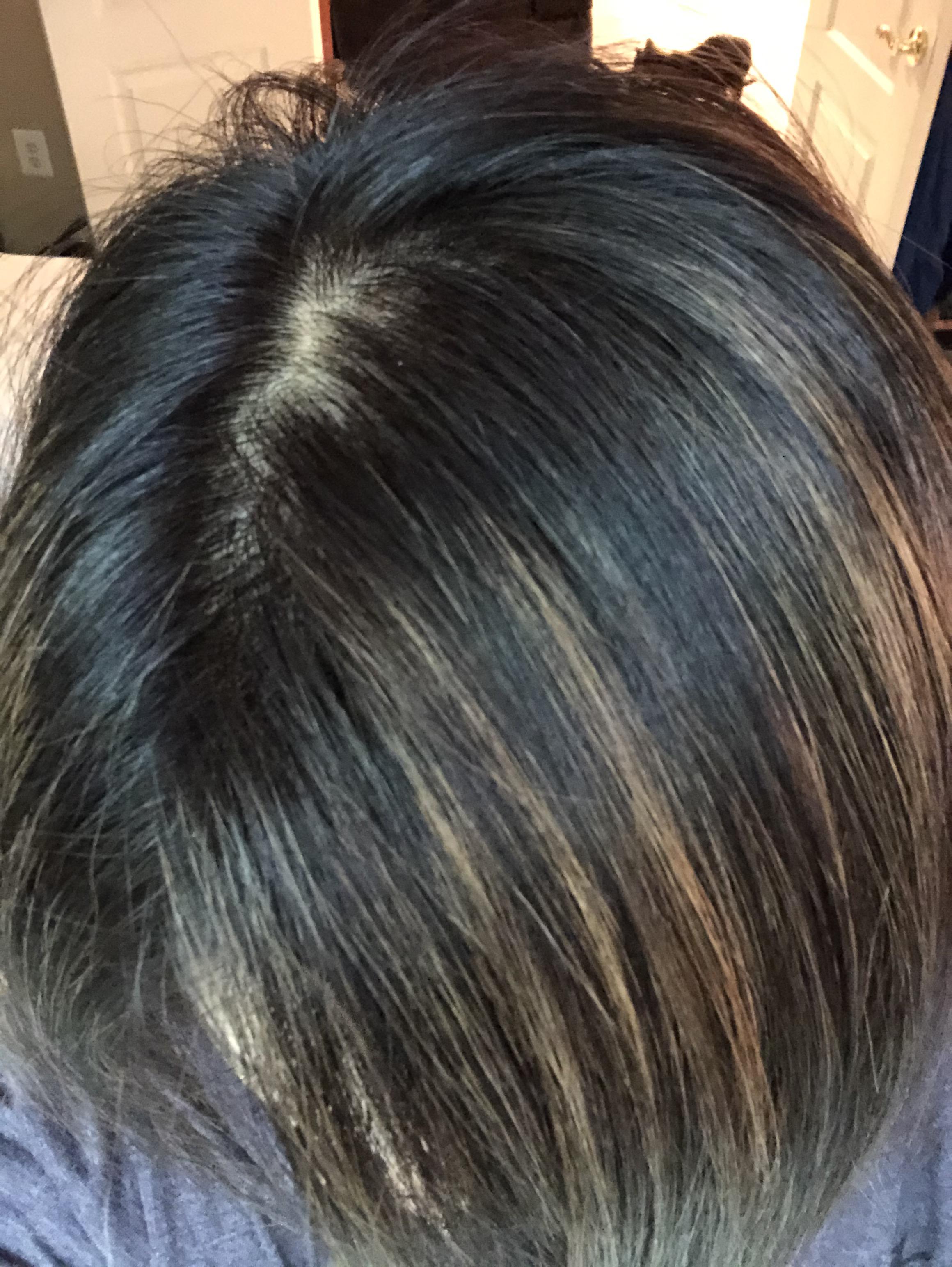 Grown out foil highlights. Anyway to DIY cap highlights where the old highlights will blend in