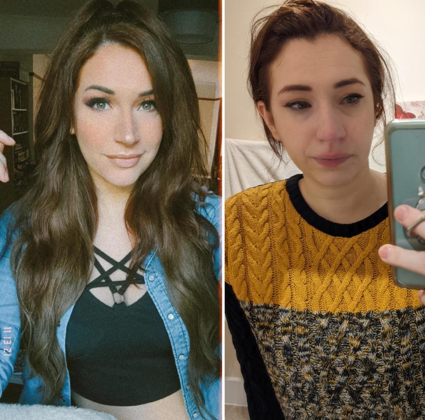 Social media isn't real. (From. Lydia's insta) I really hope she can