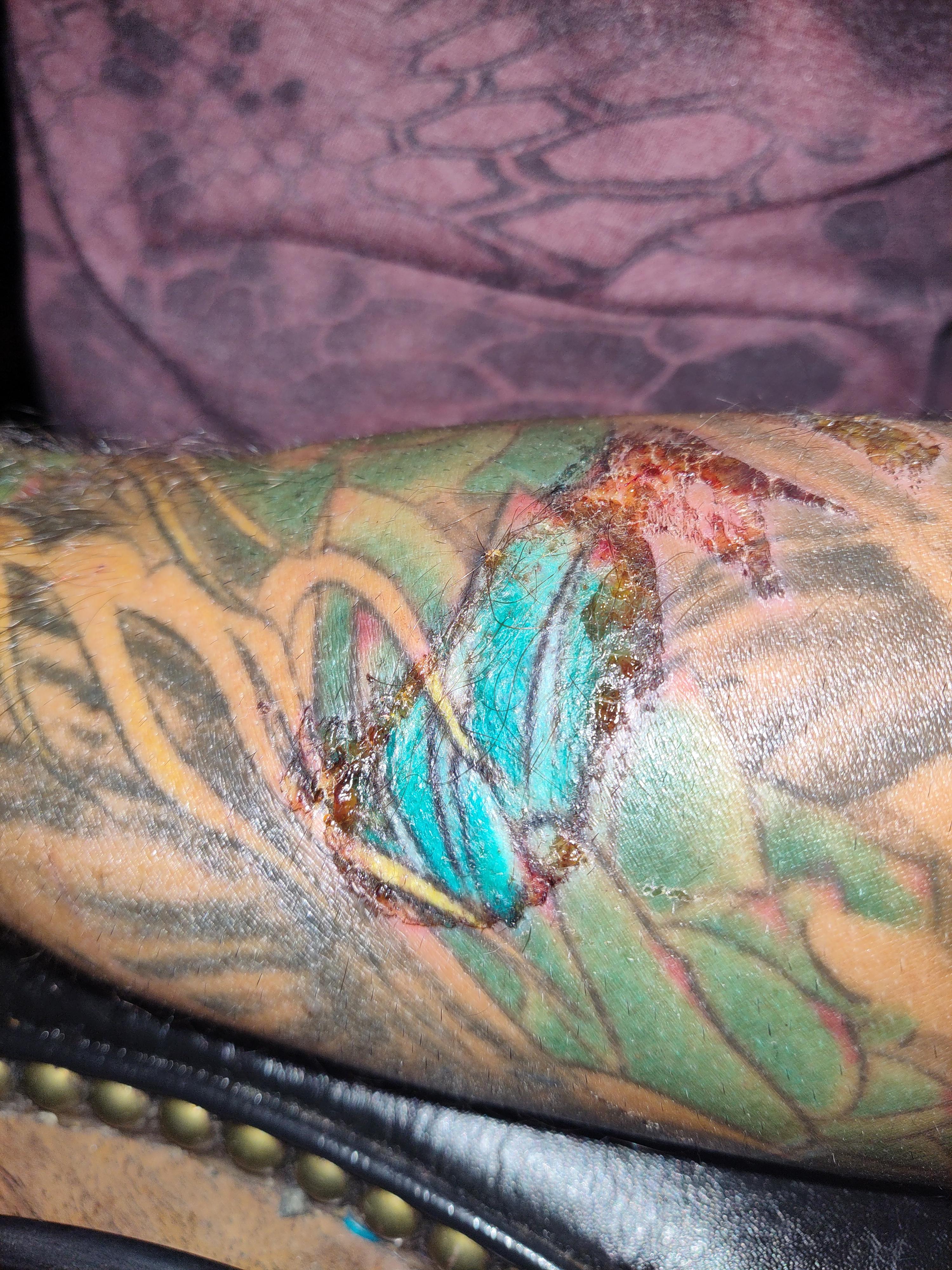 Rope Burn on a Tattoo r/mildlyinteresting