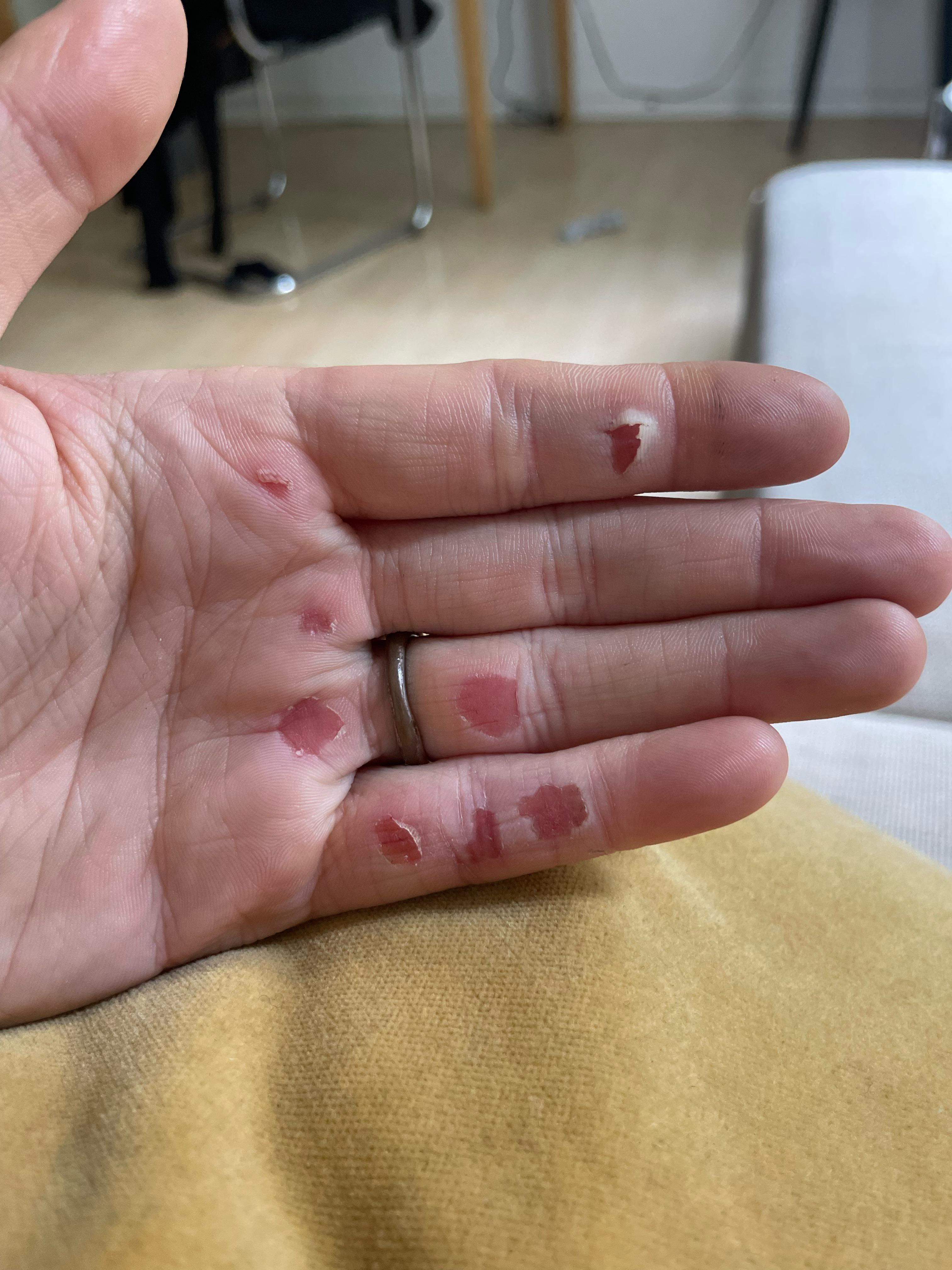 Handcuts after bouldering for the first time r/bouldering
