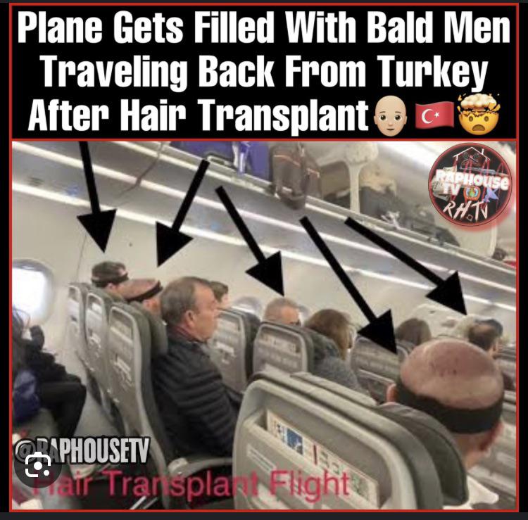 Hat at airport/ airplane? r/Hairtransplant