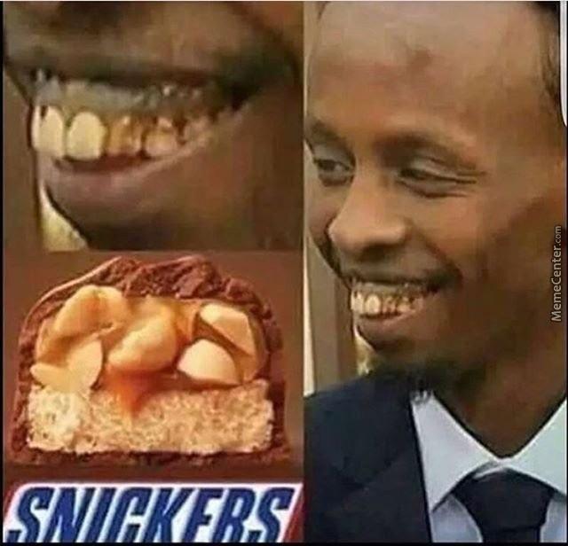 his teeth look like snickers i guess ComedyCemetery