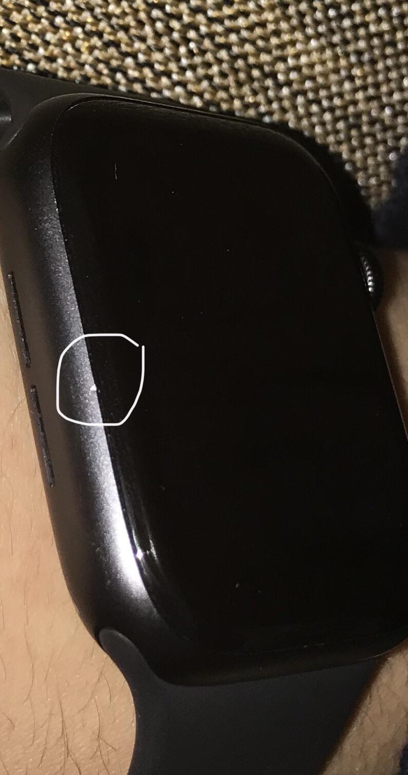 Is this a serious scratch? Is it worth replacing the Watch (I have