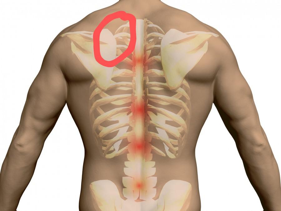 Anyone get a dull ache here with deep breath? r/costochondritis