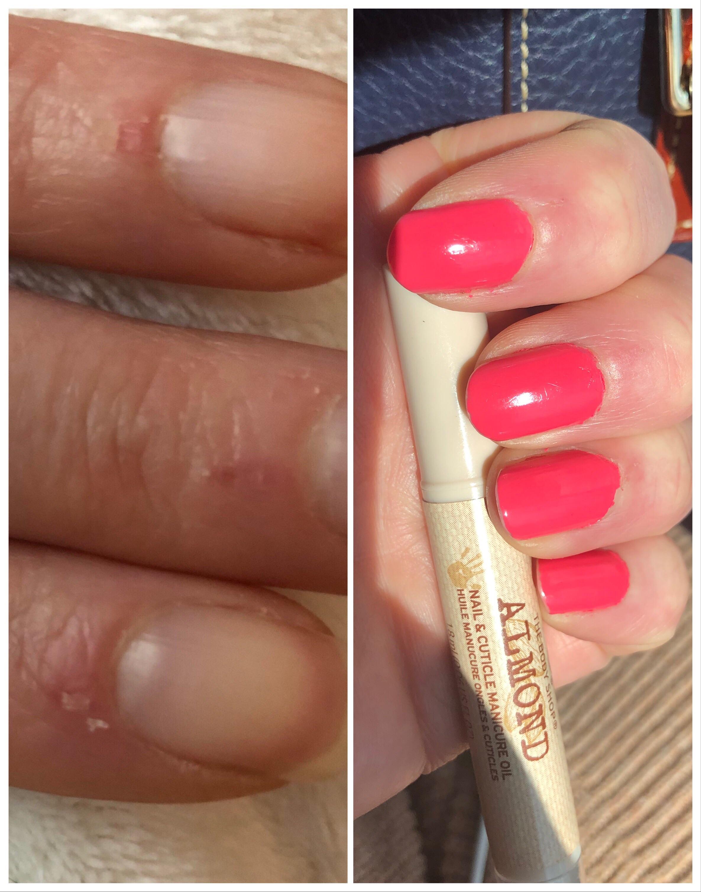 Body Shop Almond Nail And Cuticle Oil How To Use Shop Poin