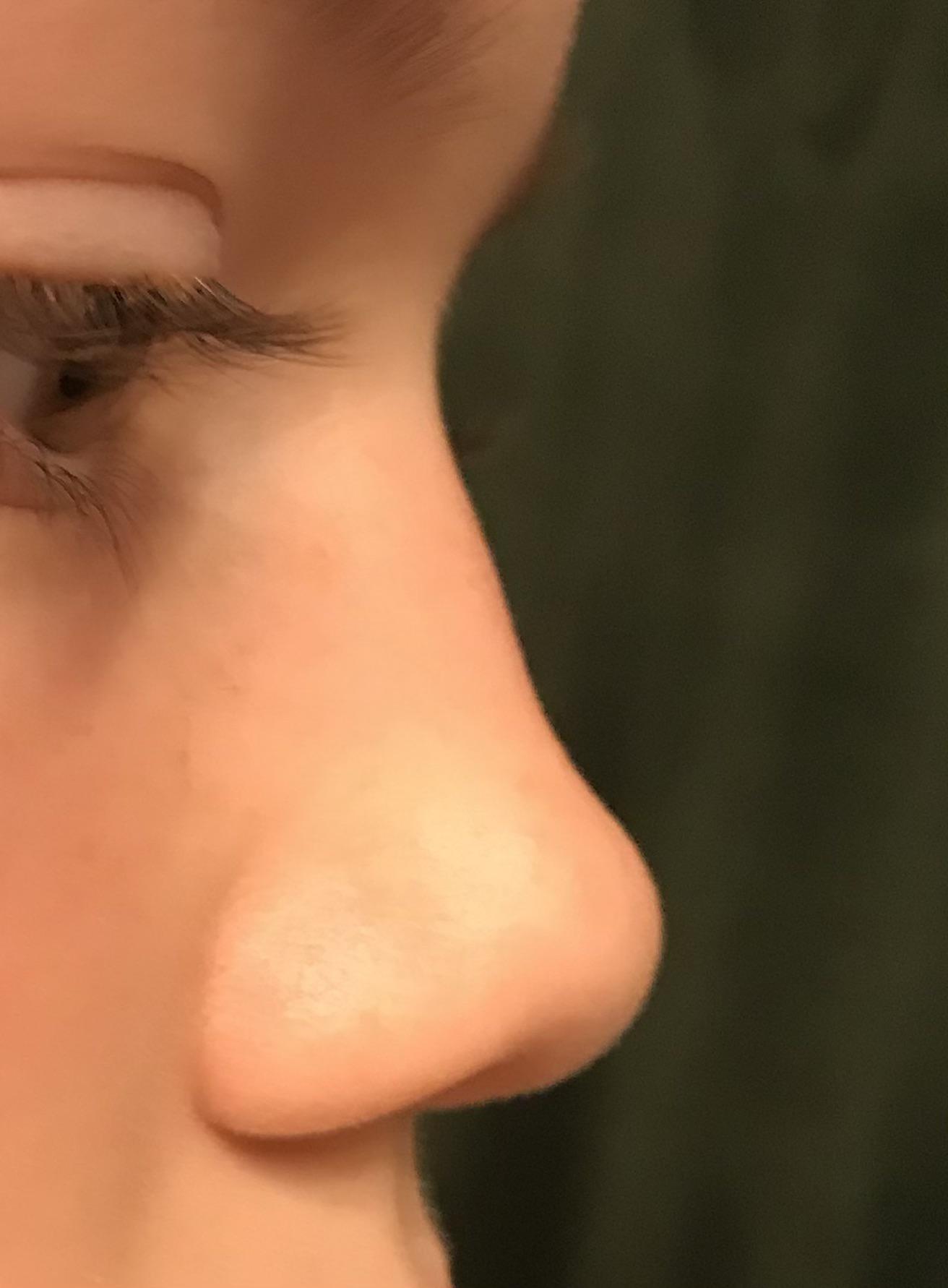 Is my nose a button nose? r/Noses