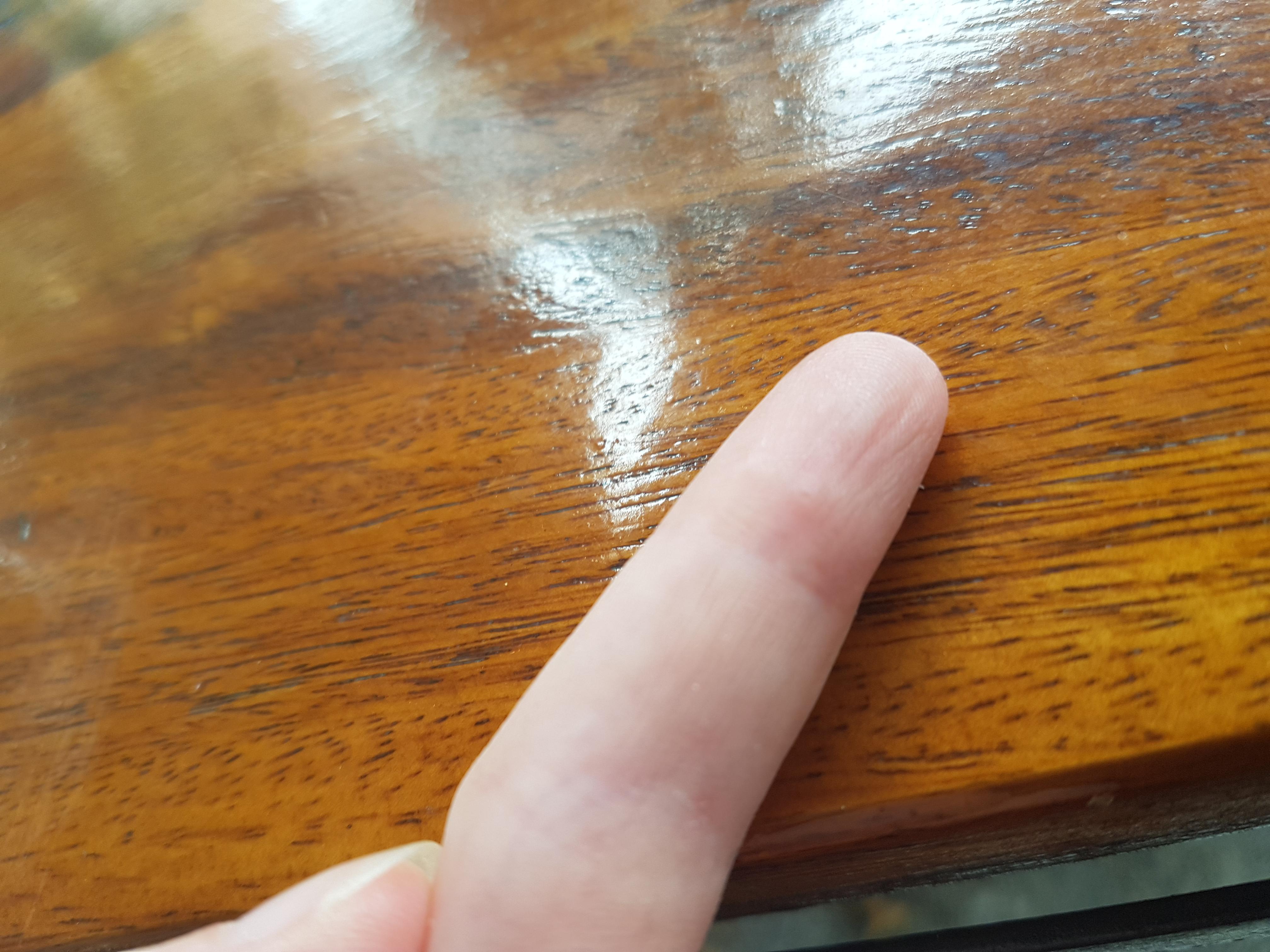 F 23, sore bumpy bubbles appearing on my fingers and hands. Anyone have