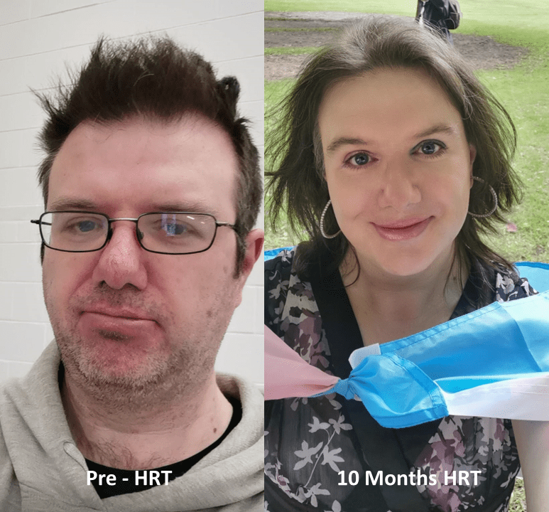 MTF (She/Her) Pre HRT to 10 Months HRT (Weight loss and makeup) r