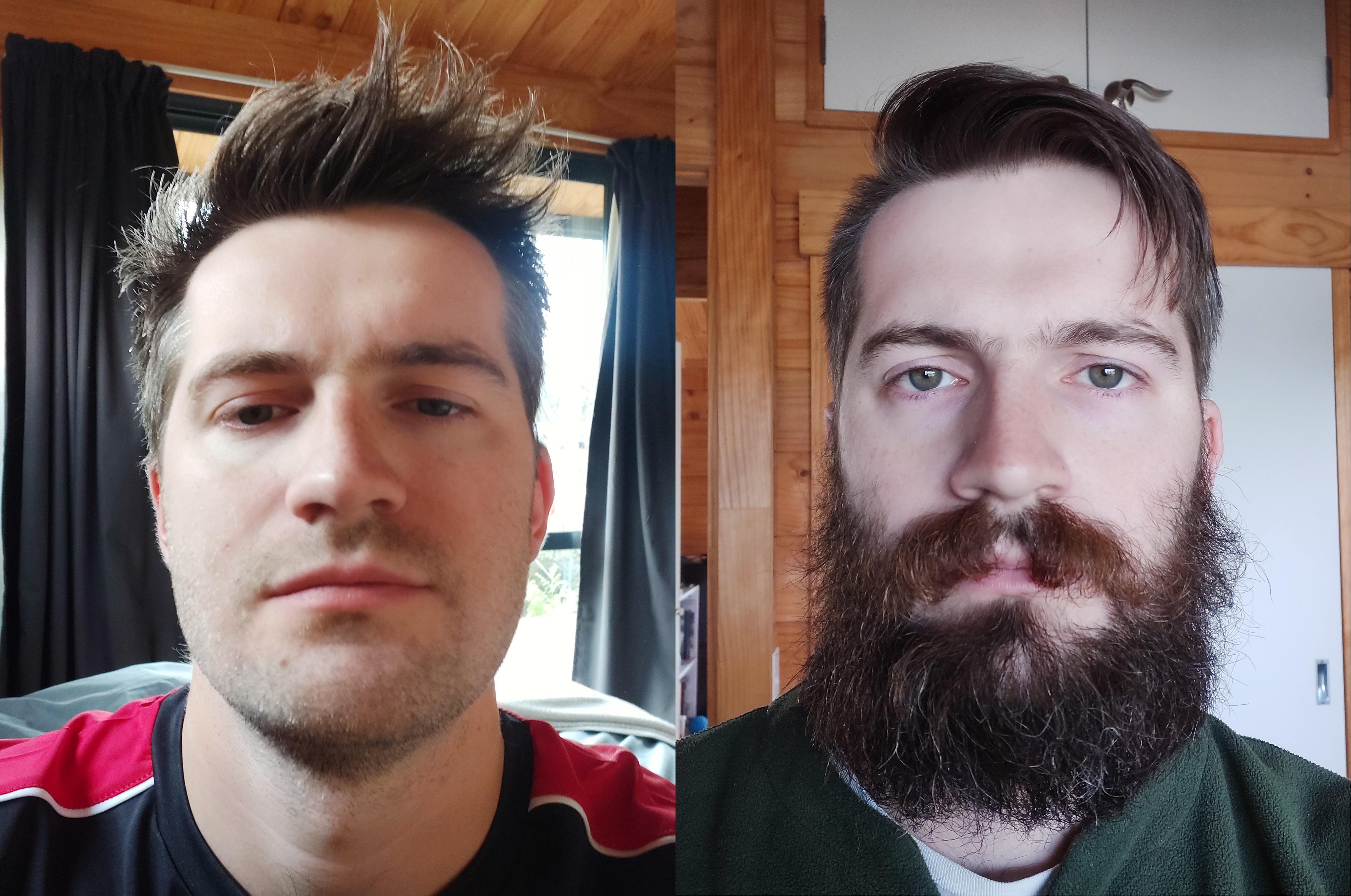 1/1/2021 1/5/2021 Four months of growing a yeard. How am I doing so