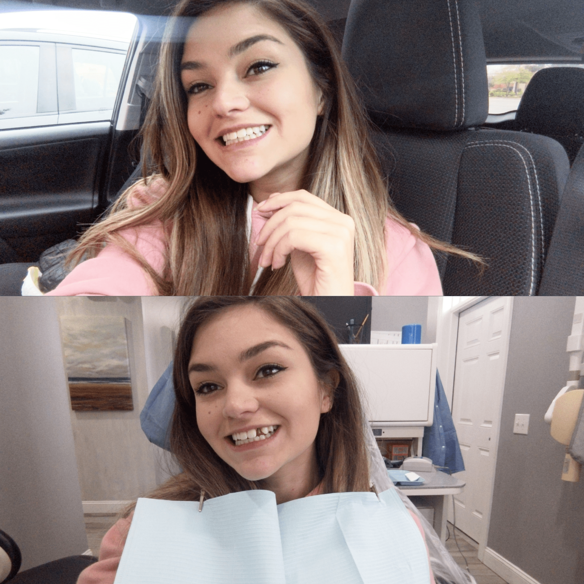 I finally got my dental implant crown yesterday and it's the happiest