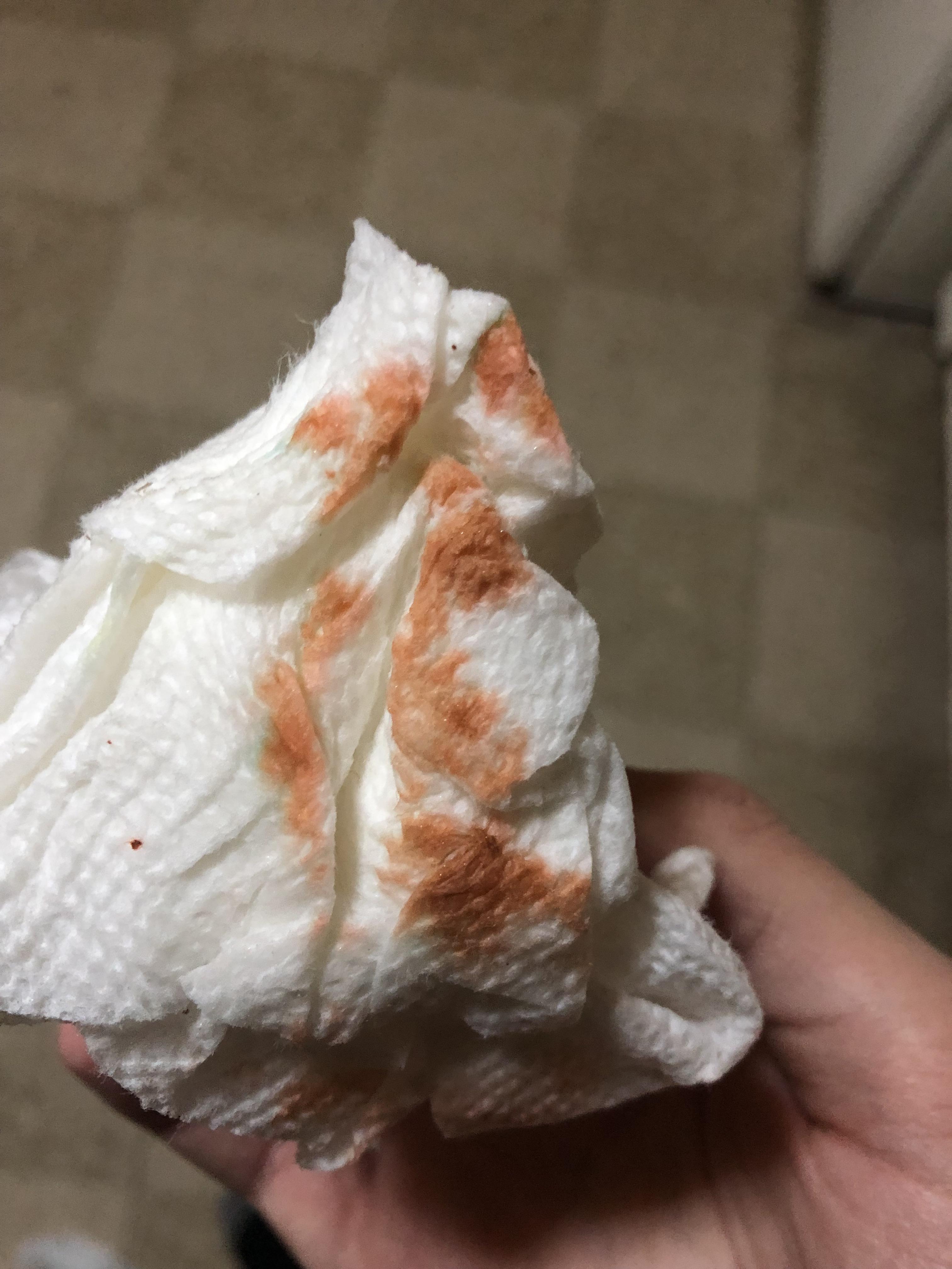 Is this normal chinchilla pee? He had a dried cherry a few hours ago. It’s a little lighter