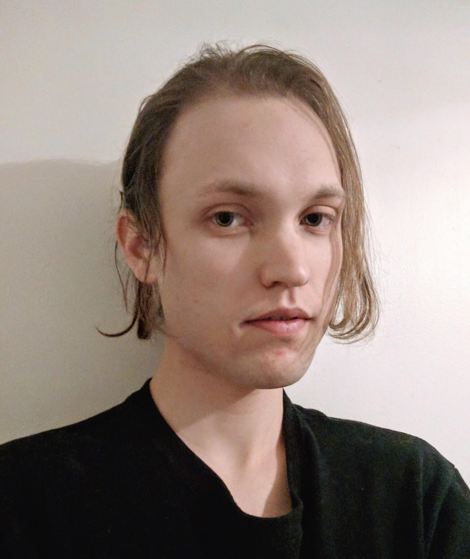 First day of E, Spiro, and Finasteride! Now we wait... and pray for