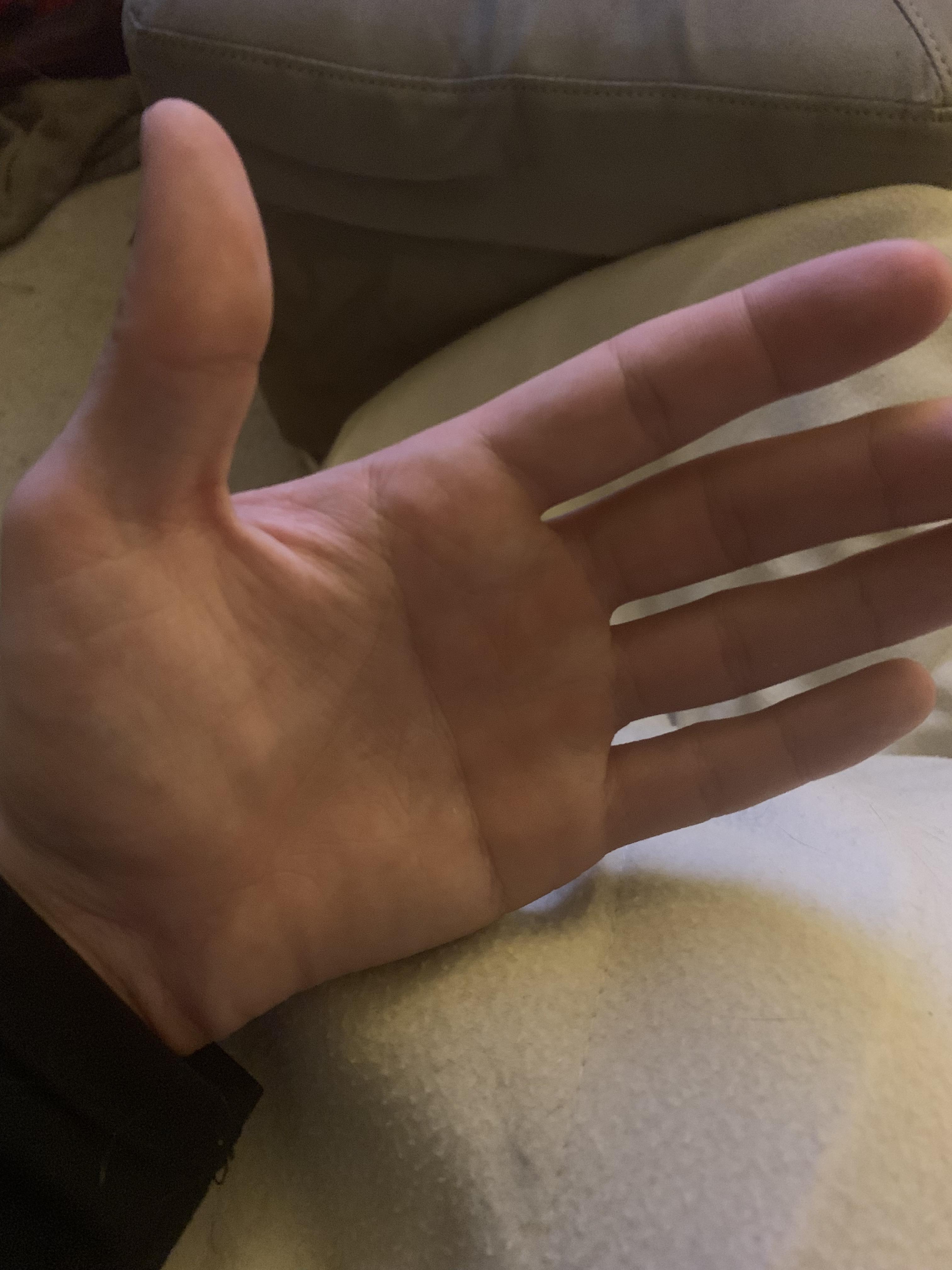 I only have one palm line and it goes straight across my hand. r