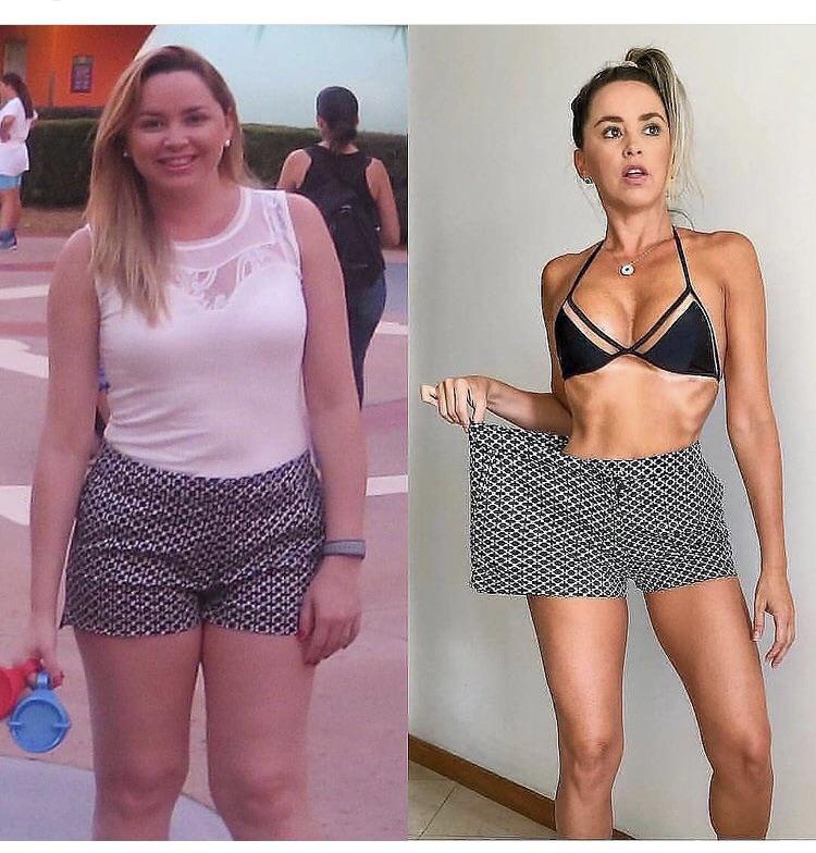 Weight Loss Before And After Women Legs