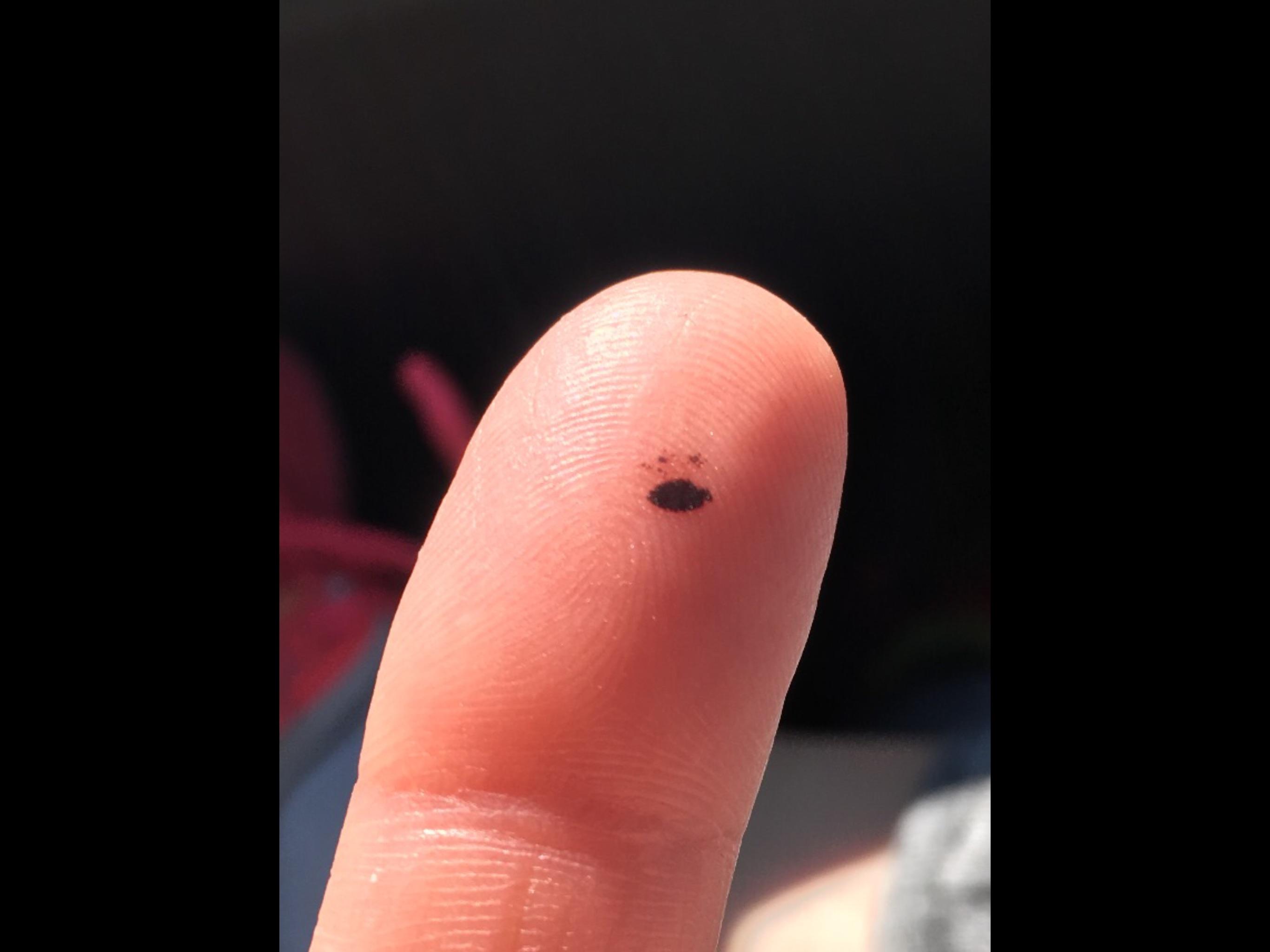 Blood blister on my finger... r/Pareidolia