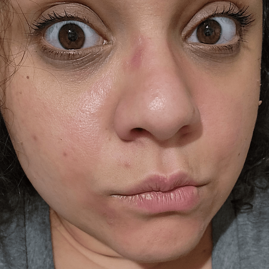 I'm almost a week into using my CPAP and my skin was pretty much