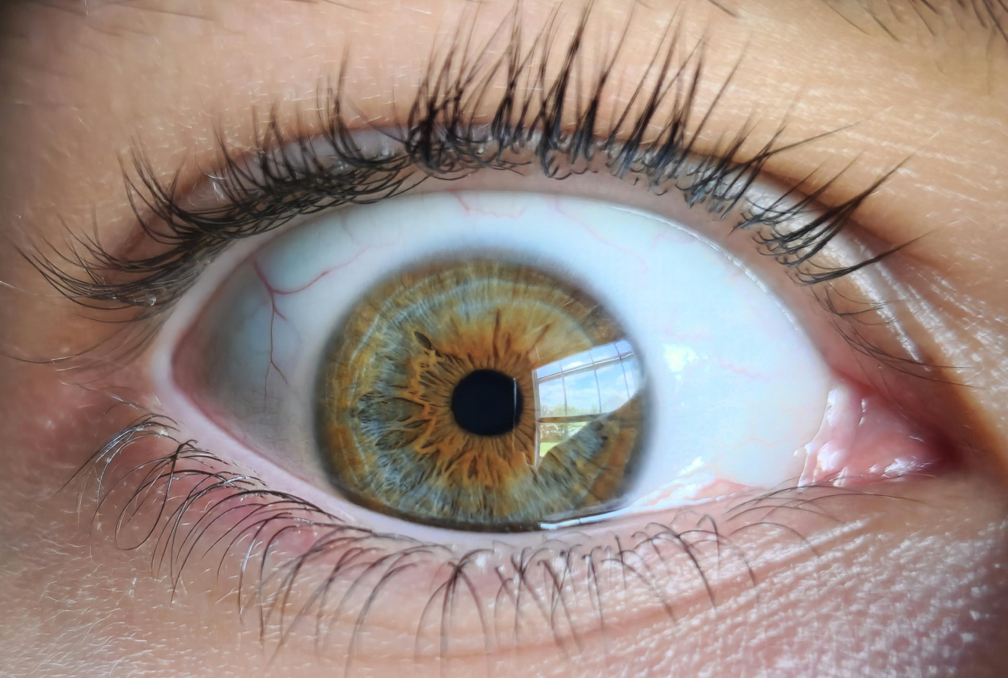 Here's some Hazel eyes