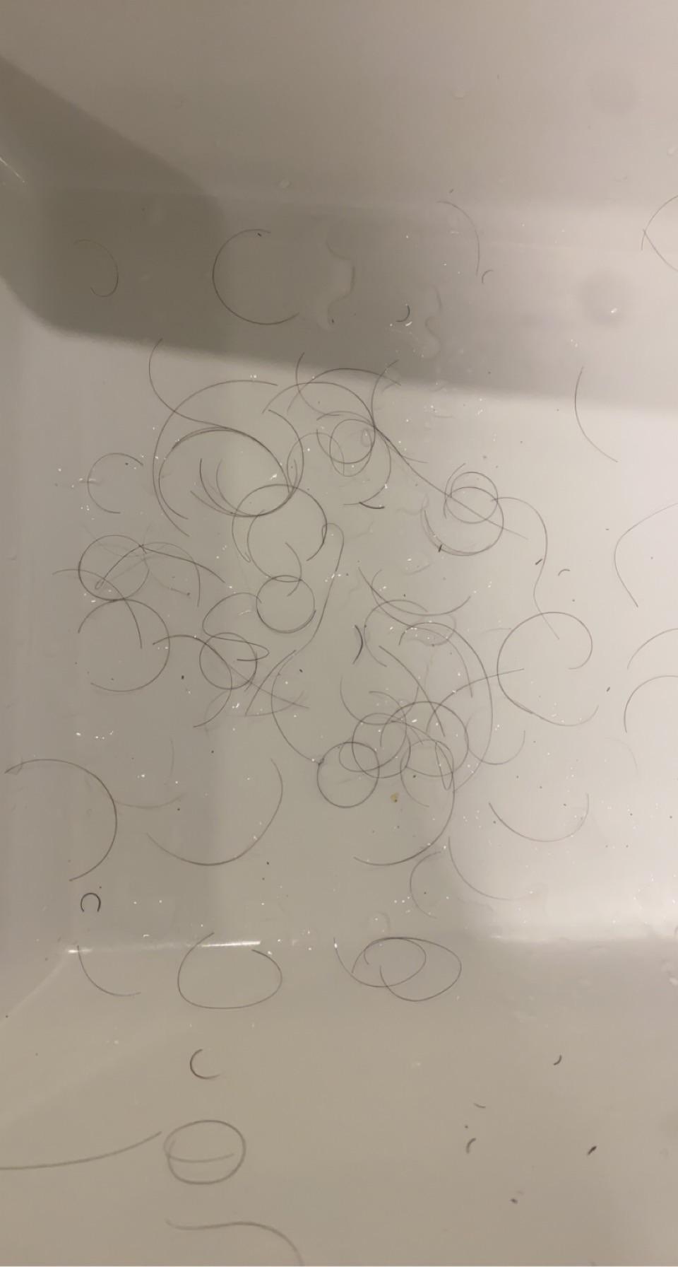 This came out of my comb after the shower, another 50 hairs in the shower floor. Is this normal