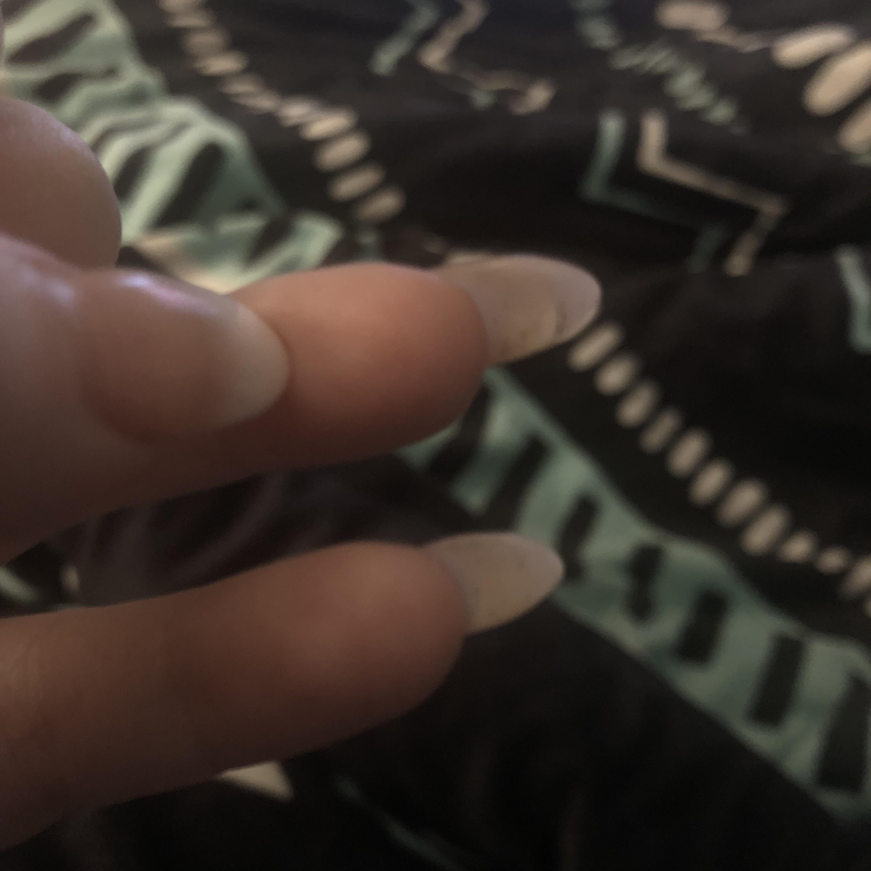 What should I do about my natural nail peeling from the acrylic tip