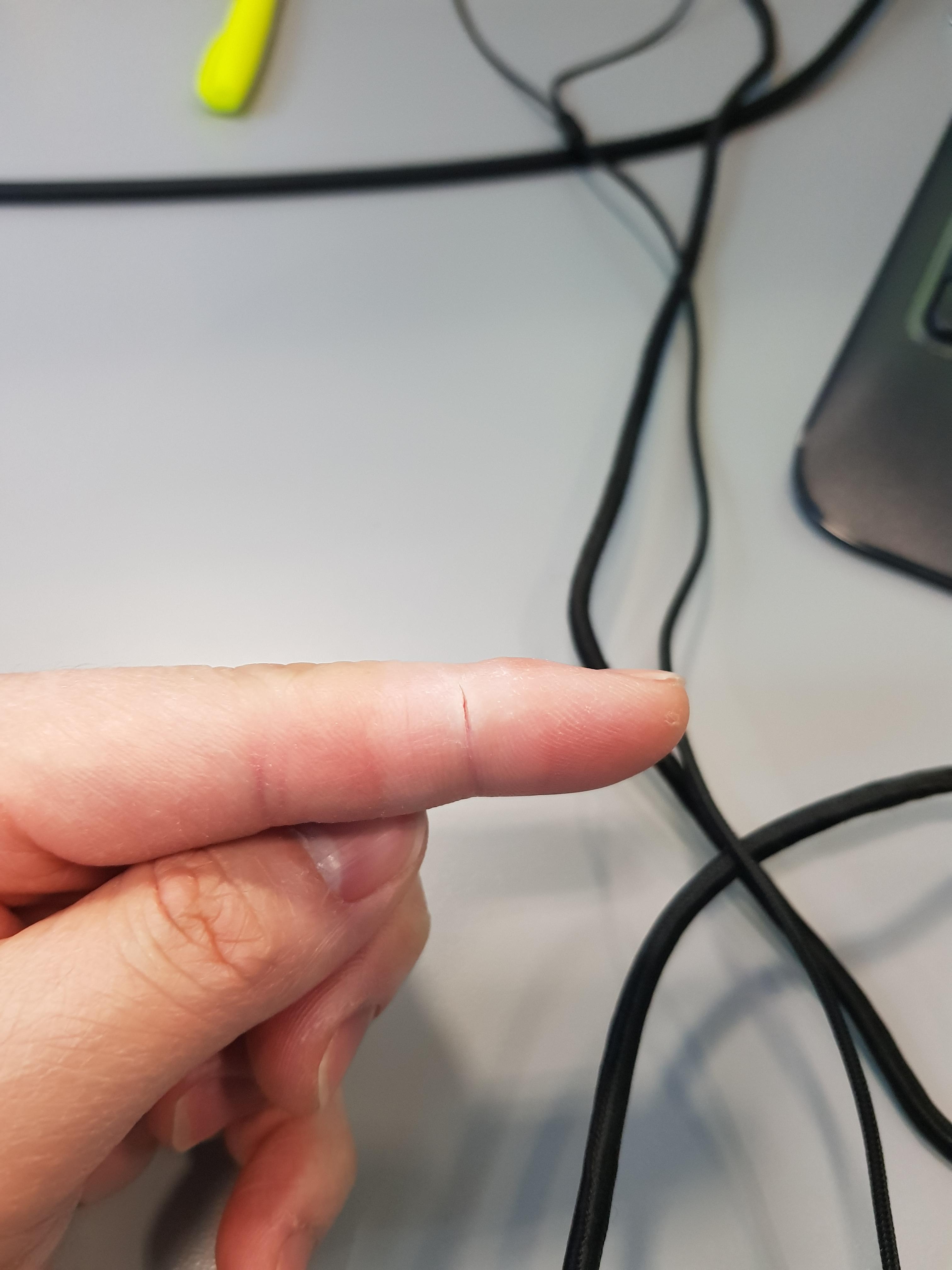 Break away string burn r/Throwers