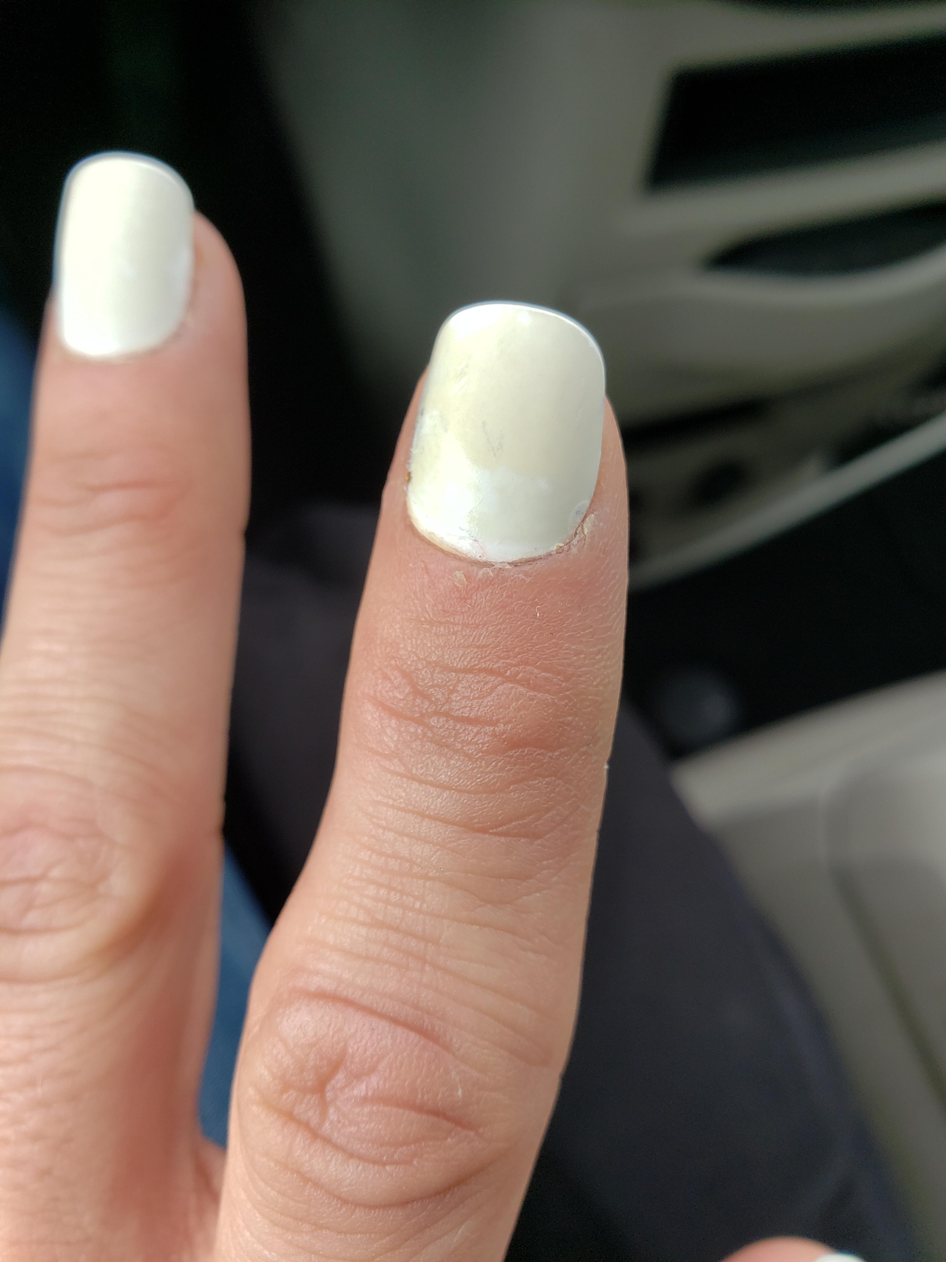 Share 147+ white nail polish turns yellow latest ceg.edu.vn