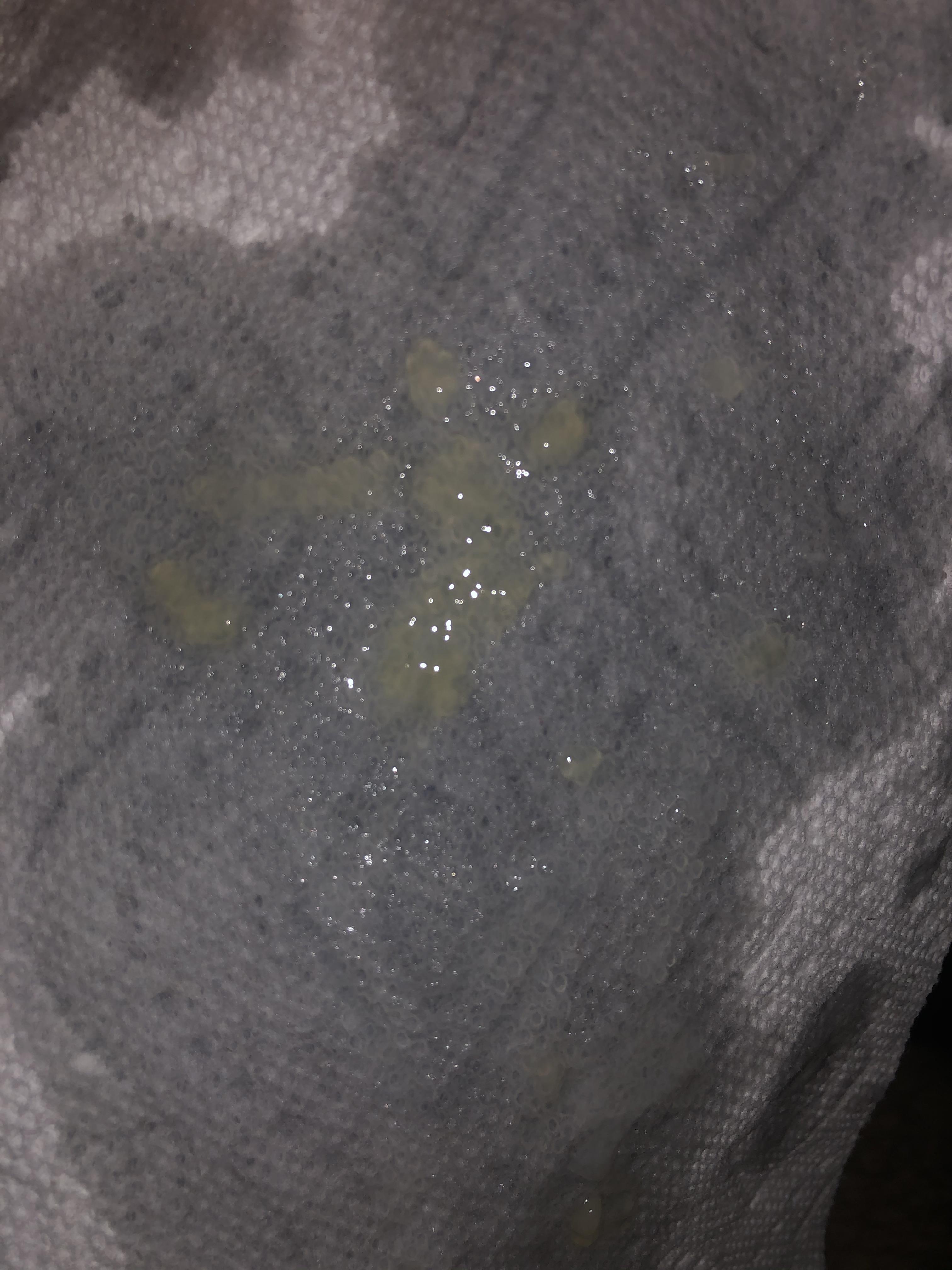 Been having gellike globules in my semen for the past year or two