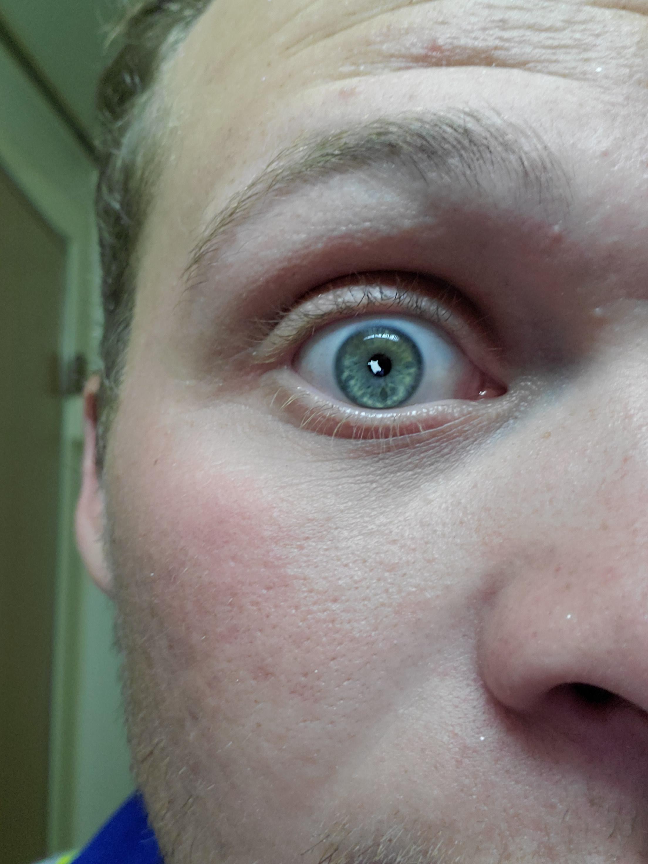 Got a paint chip in my eye today. Contact lense saved me. r