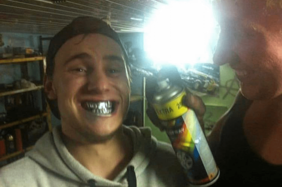 Spray painting your teeth r/MakeMeSuffer