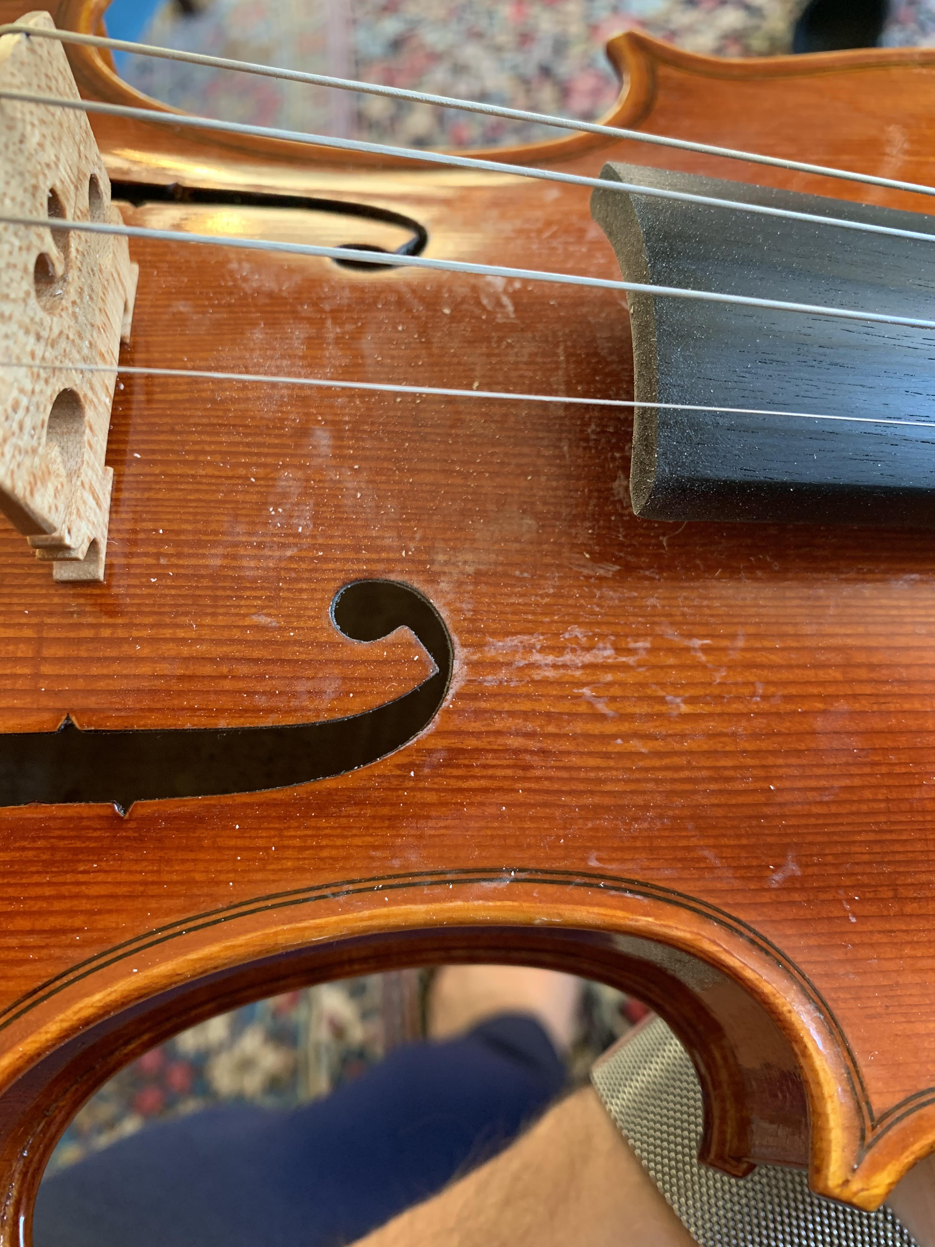 Unusual stains of rosin r/violinist