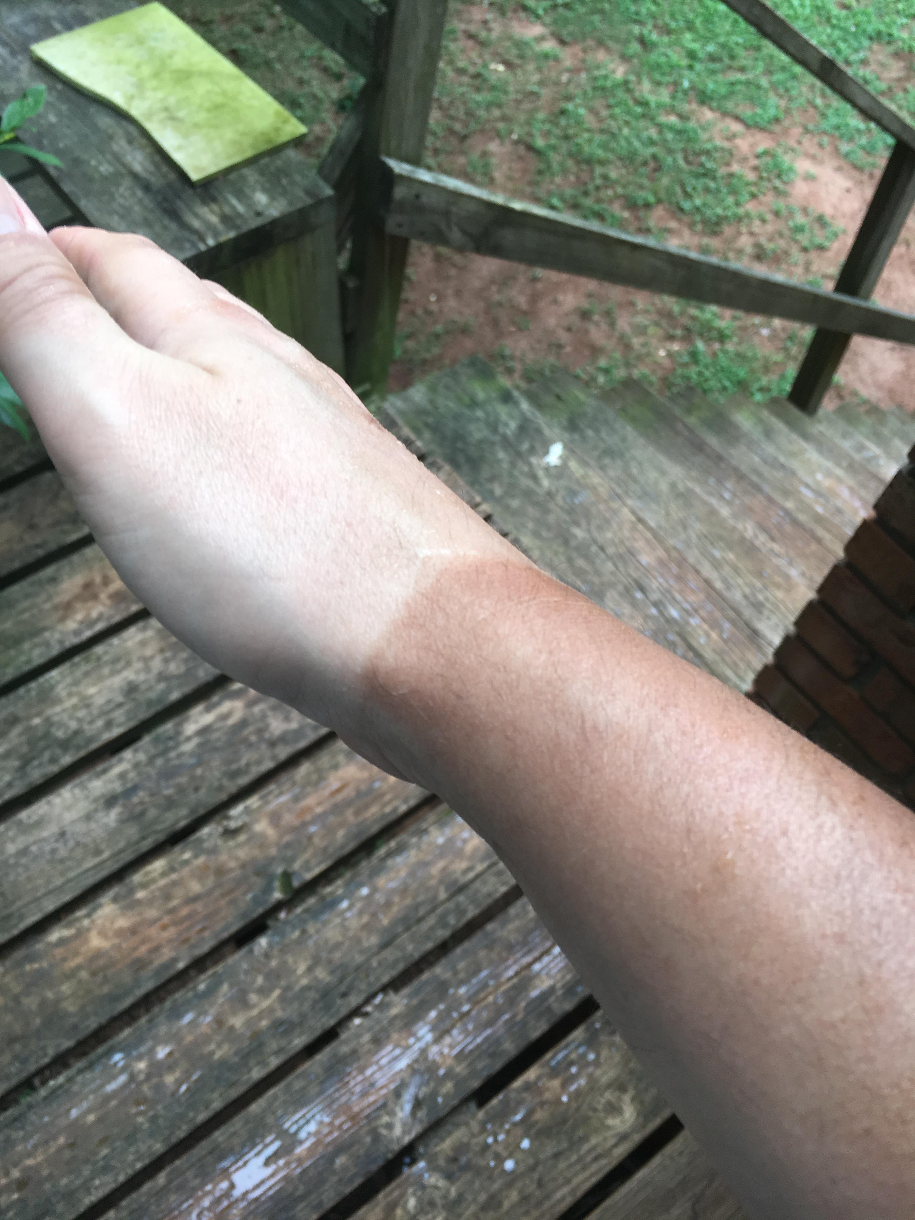 Y’all are talking about tan lines? I was out training for a triathlon