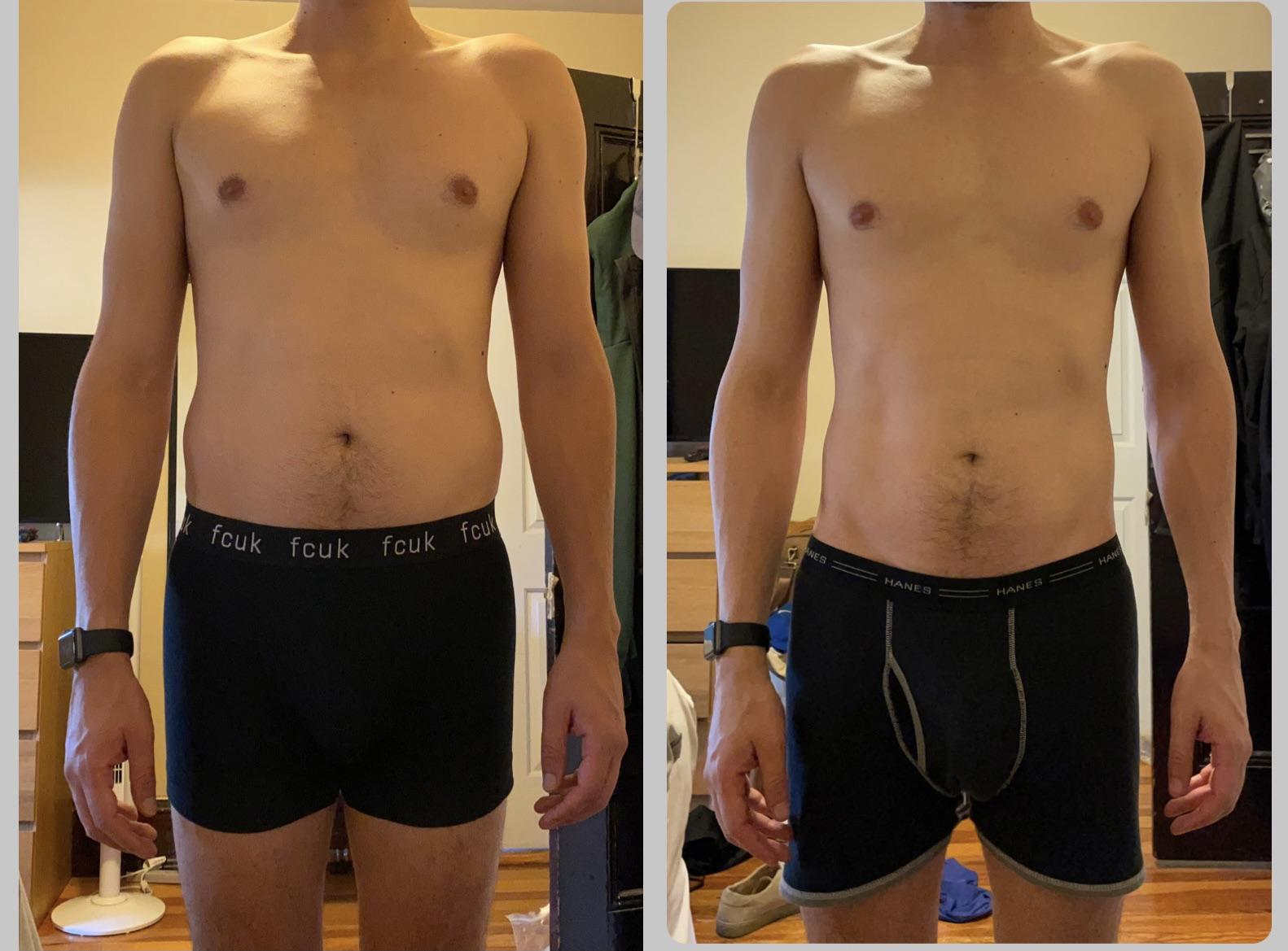 Skinny fat — should I do slow lean bulk or keep in caloric deficit