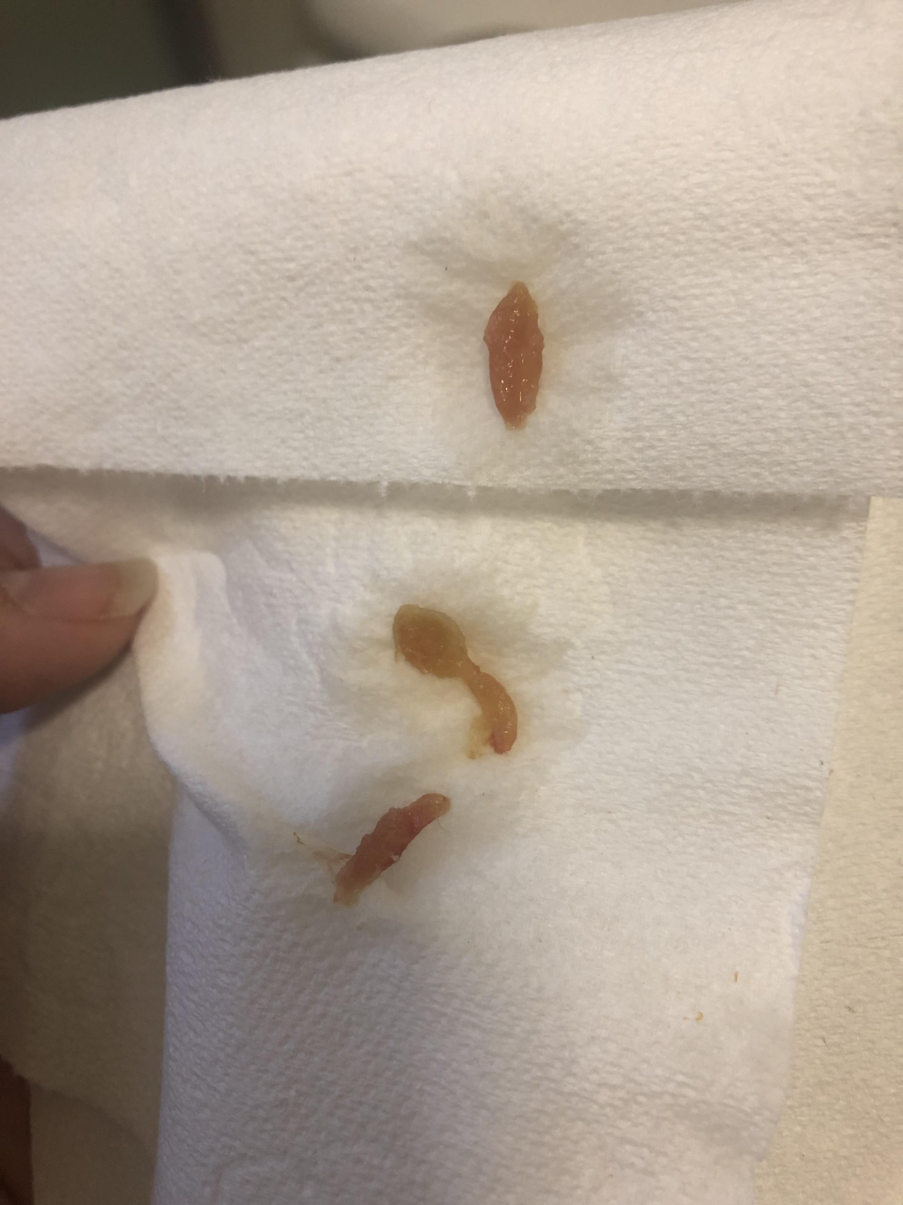 Coffee Enema Parasites