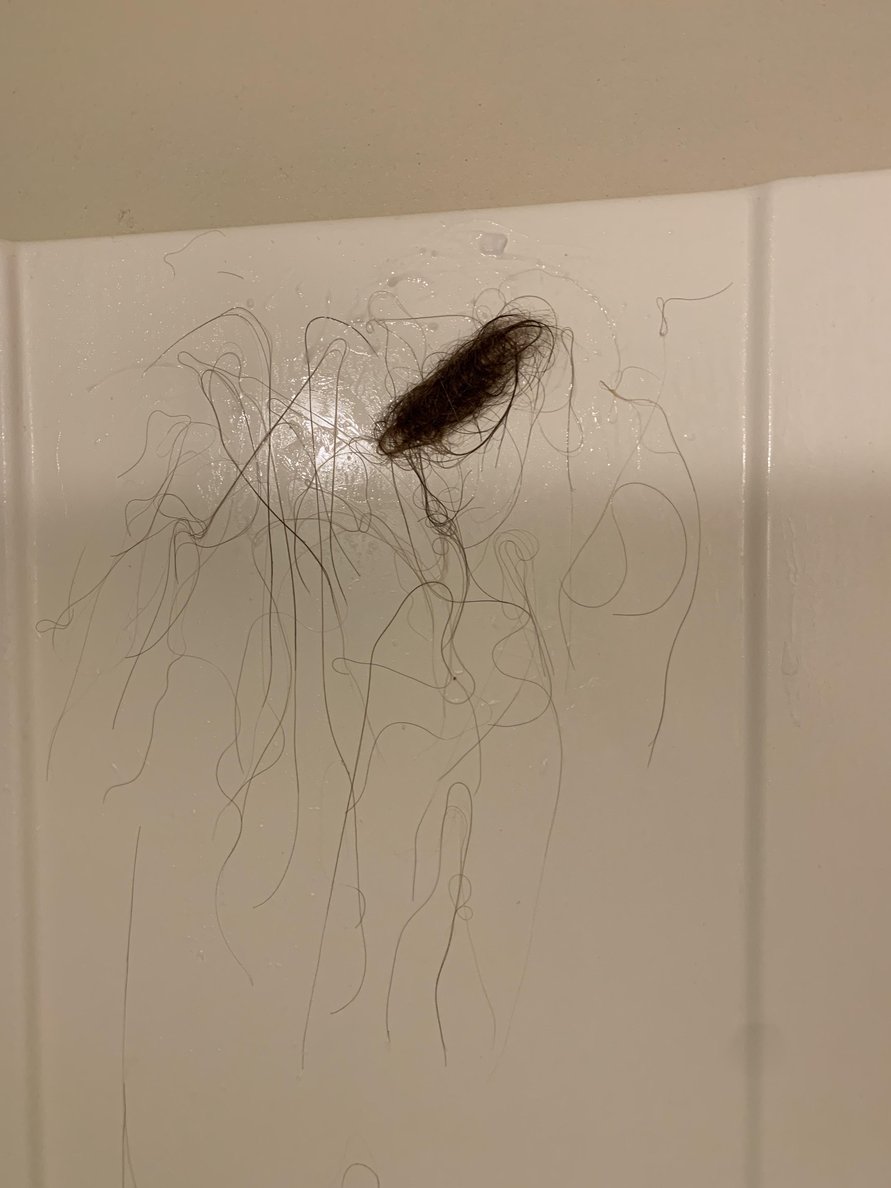 Is it normal to lose this much hair? I only brush my hair once a week