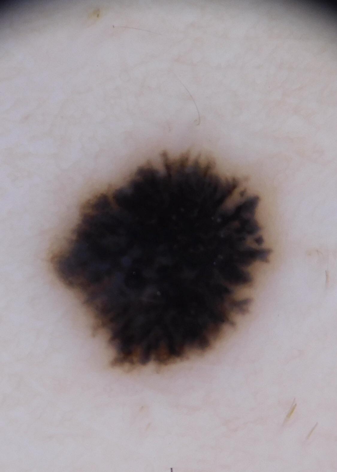 [Misc] The importance of sun protection AND getting unusually shaped or