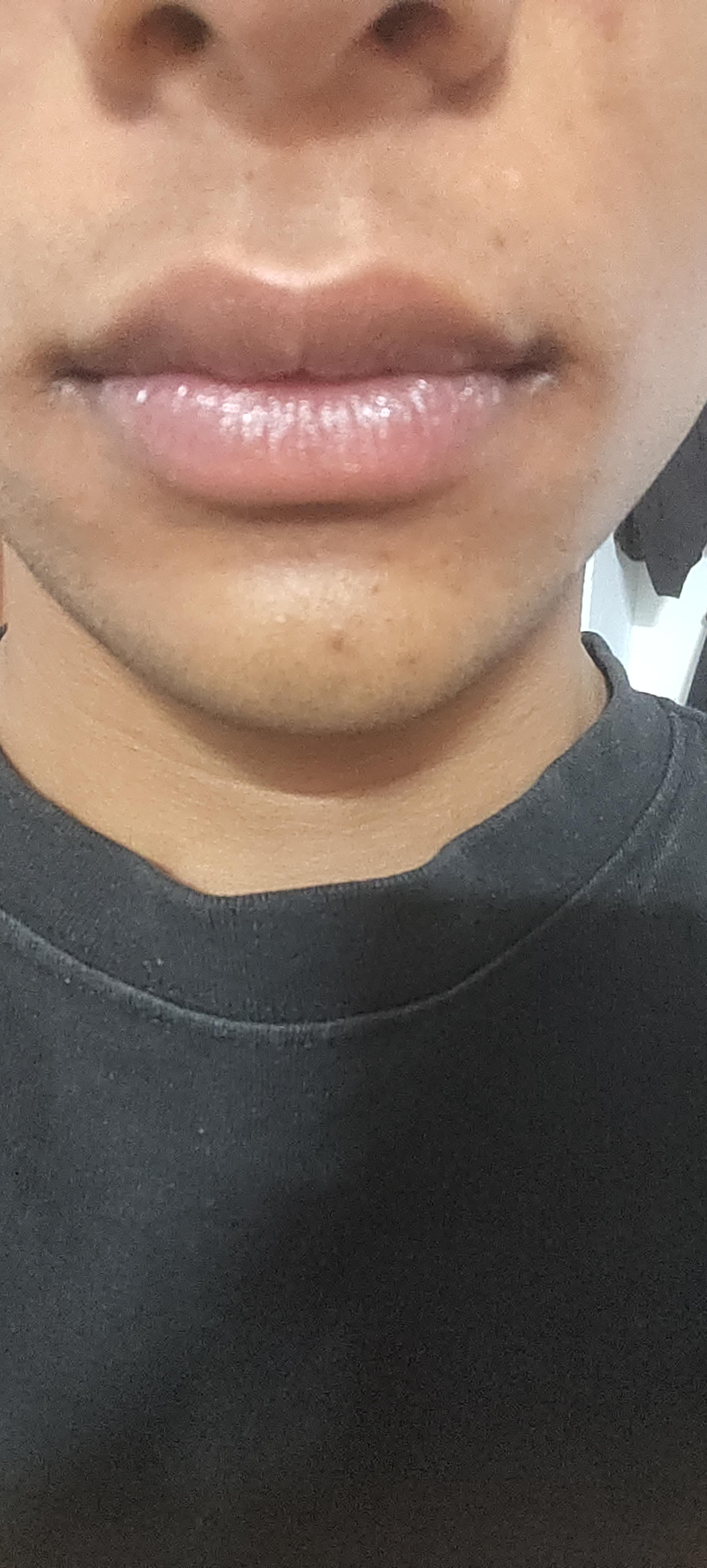 My Lips Feel Dry But Aren’T Chapped Reddit Glenda's Blog