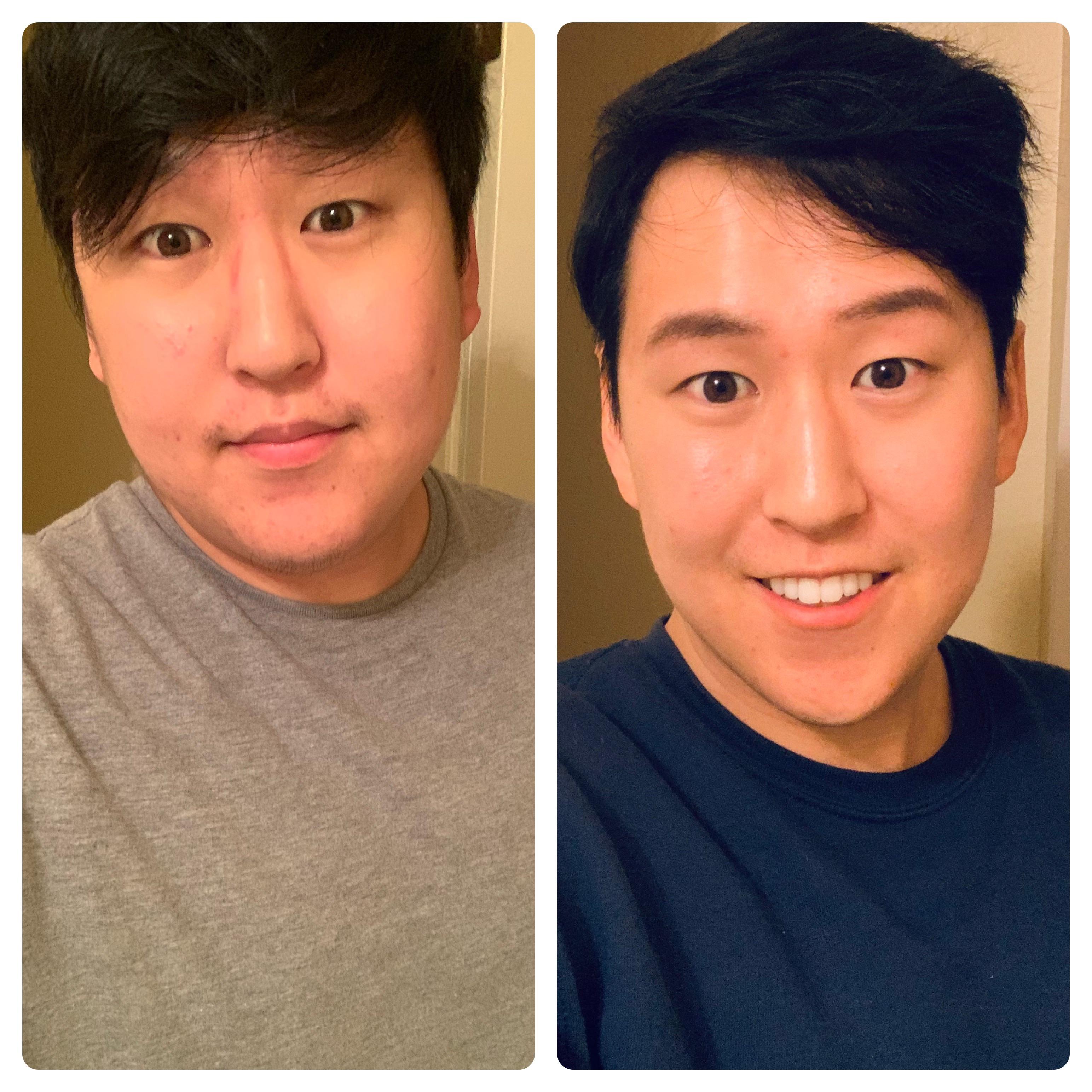 M/25/5ft7in [175>140 LBS] 6 month 35 pound weight loss. Can’t wait to